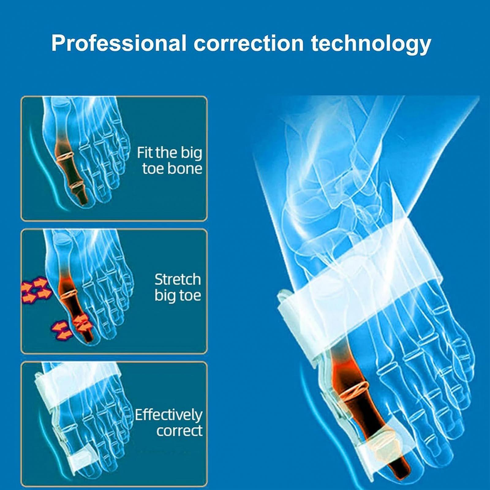 Коректор Вальгусної Деформації (2 шт.) Регульований Розмір для Чоловіків та Жінок, фото №4
