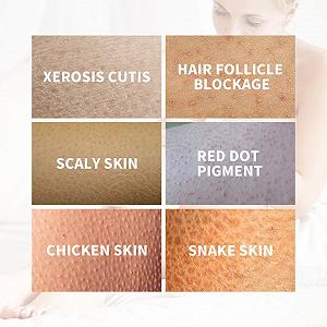 Гель для душу BEALIFE Fat Removal жіночий відлущувальний з натуральними інгредієнтами, тип 1 synthetic.ua - Фото 1