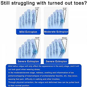Коректор великого пальця стопи для жінок та чоловіків, шина synthetic.ua - Фото 1