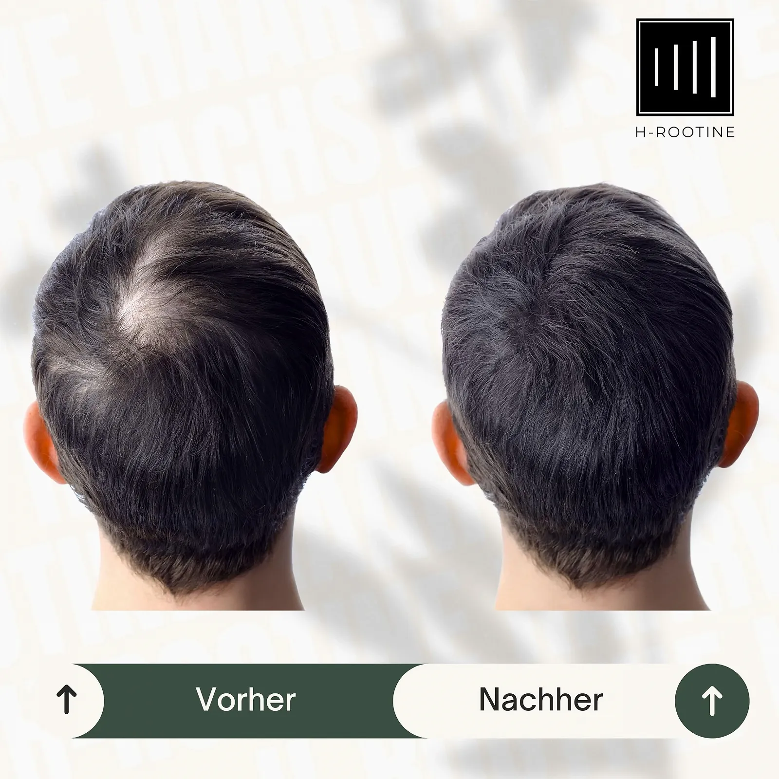 Сироватка для волосся H-ROOTINE для чоловіків 100 мл, фото №7