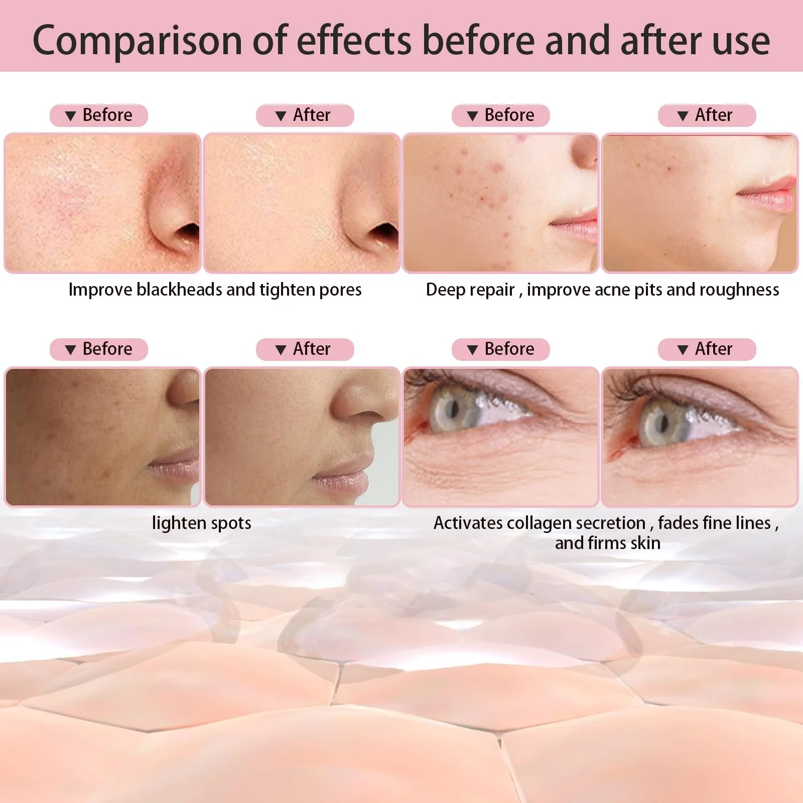 Бездротова LED маска для обличчя Beauty, 7 кольорів, світлова фотонна спа-терапія для обличчя, фото №4