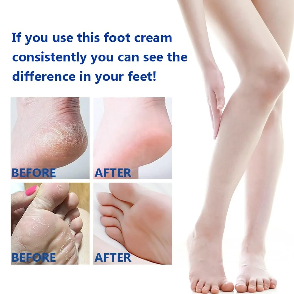 Крем для ног увлажняющий против трещин с салициловой кислотой 60% для экстремальной сухости, фото №4