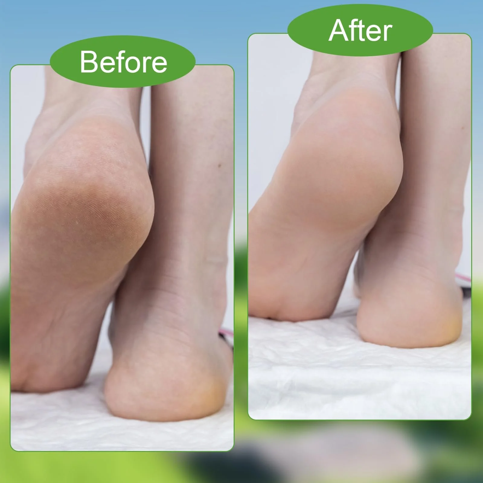 Крем для ног Urea 42% Urea с алое вера и маслом чайного дерева 100 г, фото №7