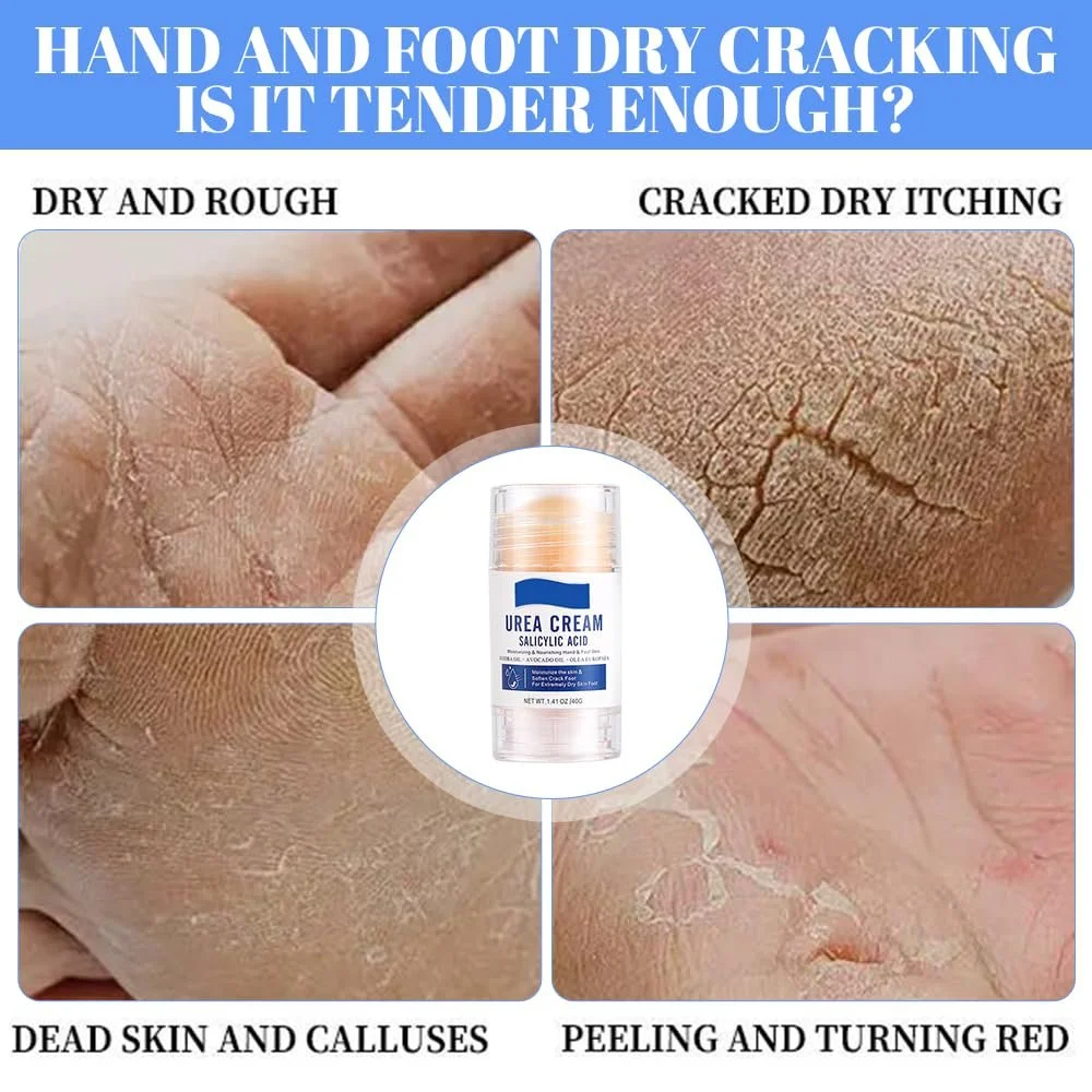 Крем для ног с мочевиной 60% Pack of 3 для сухой и потрескавшейся кожи, фото №2