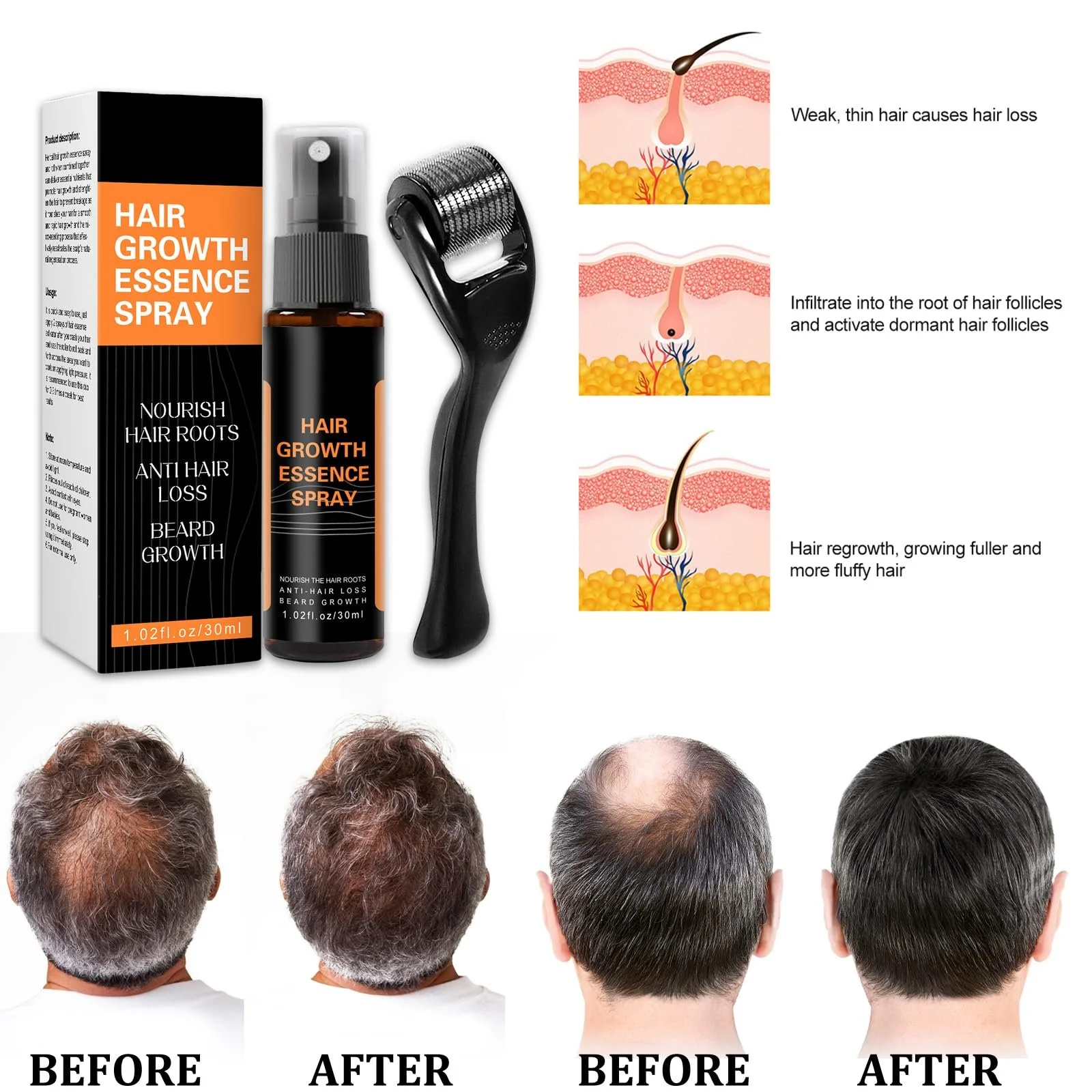 Есенція для росту волосся Спрей проти випадіння волосся, фото №4 Есенція для росту волосся Спрей проти випадіння волосся, фото №4