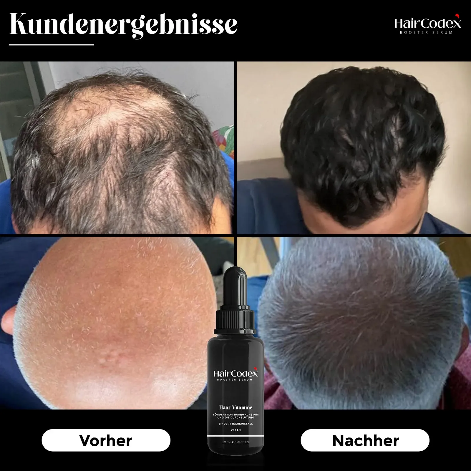 Сироватка-бустер HairCodex 50 мл, Агент для росту волосся, фото №8