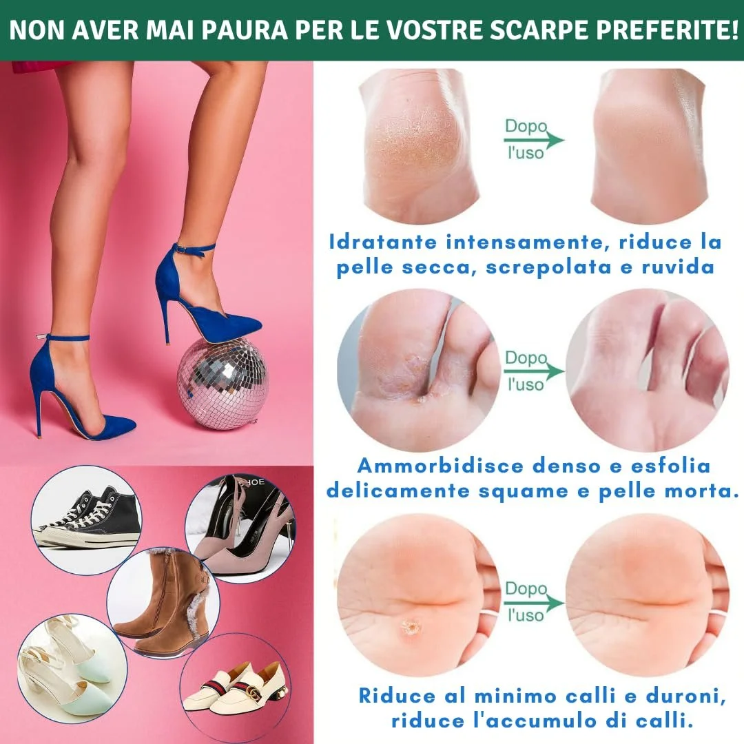 Крем для ног Eladerm с мочевиной 30% 100 мл, фото №8 Крем для ног Eladerm с мочевиной 30% 100 мл, фото №8