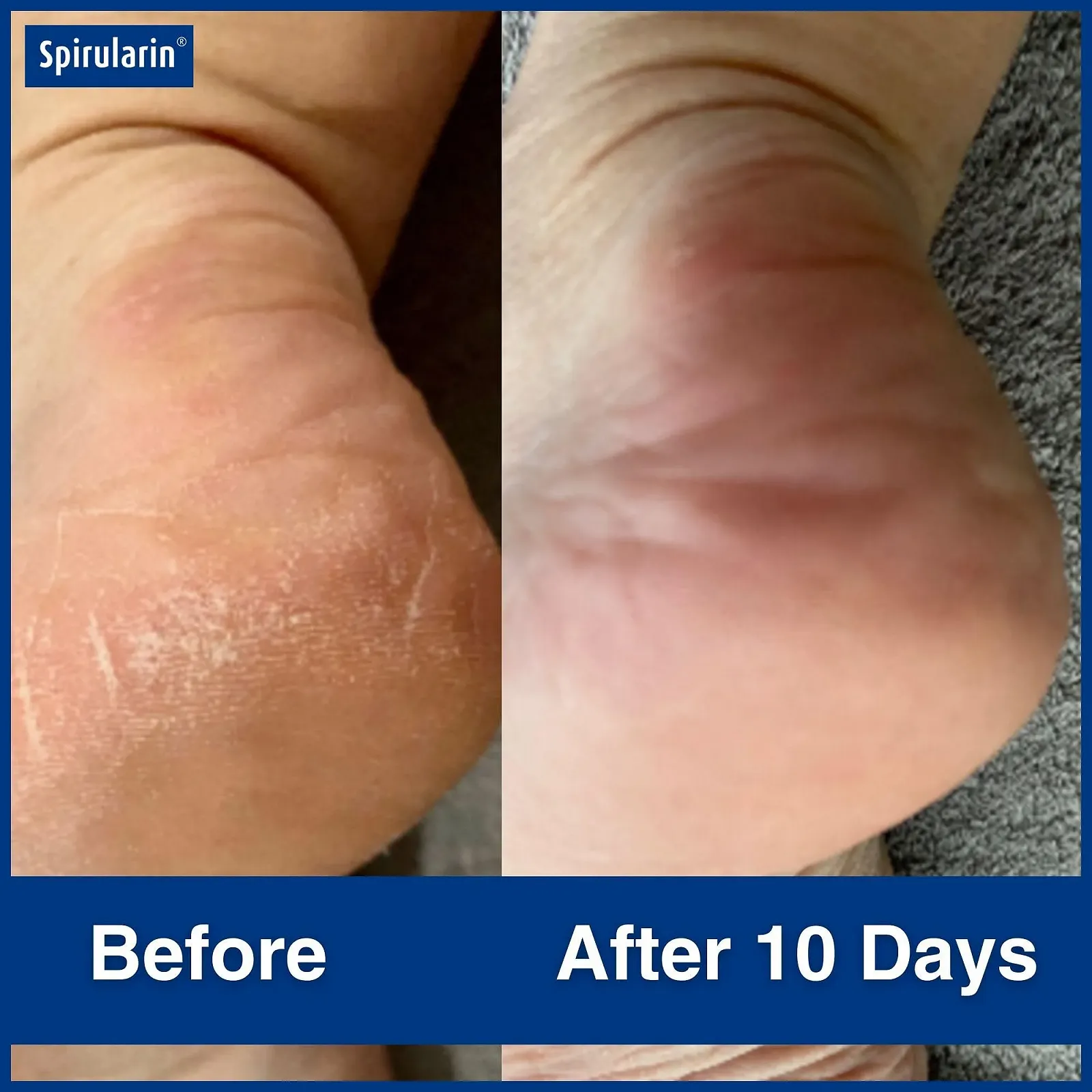 Крем Spirularin SR Urea 75 ml, фото №7