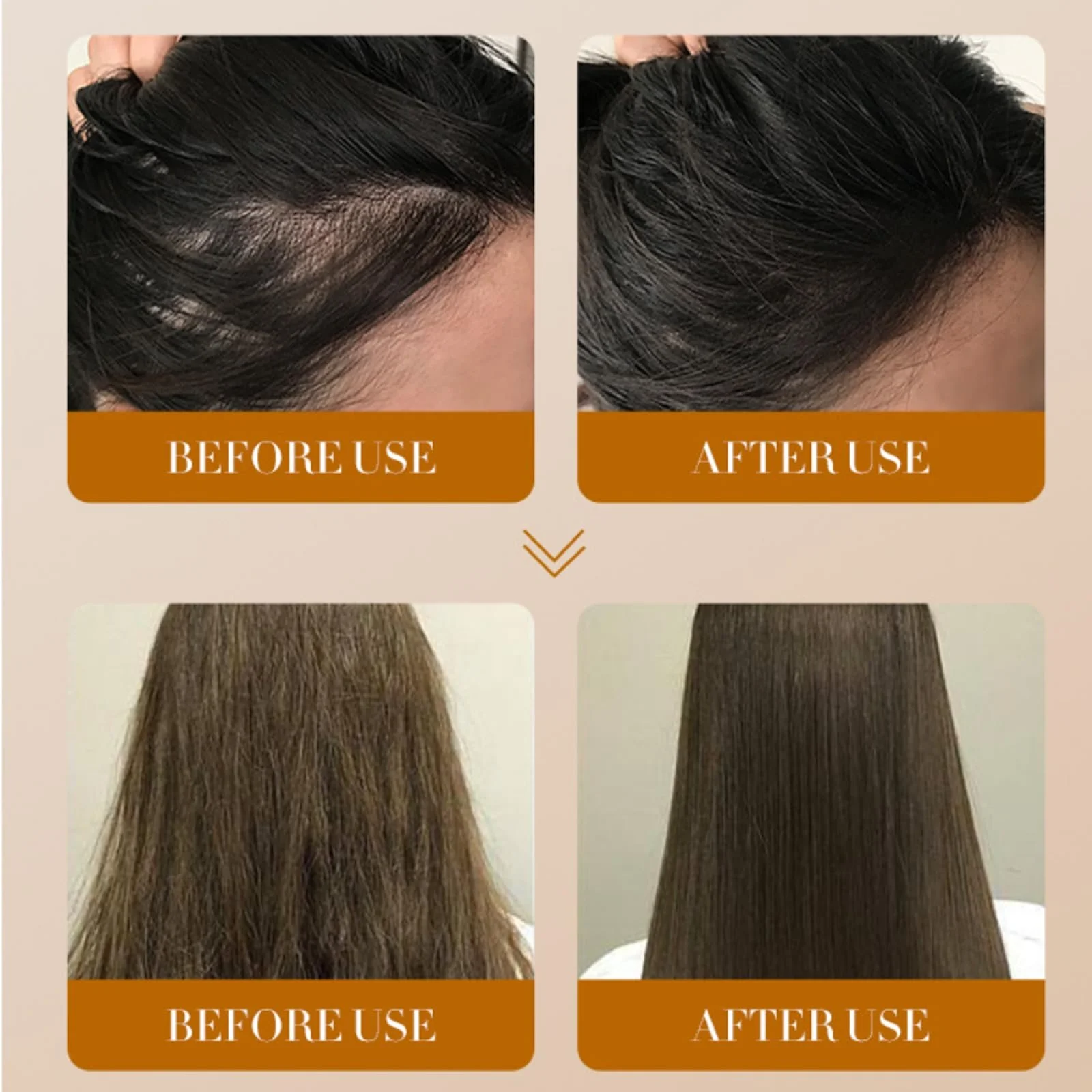 Есенція Rostblant Імбирна для росту волосся для чоловіків та жінок, фото №6