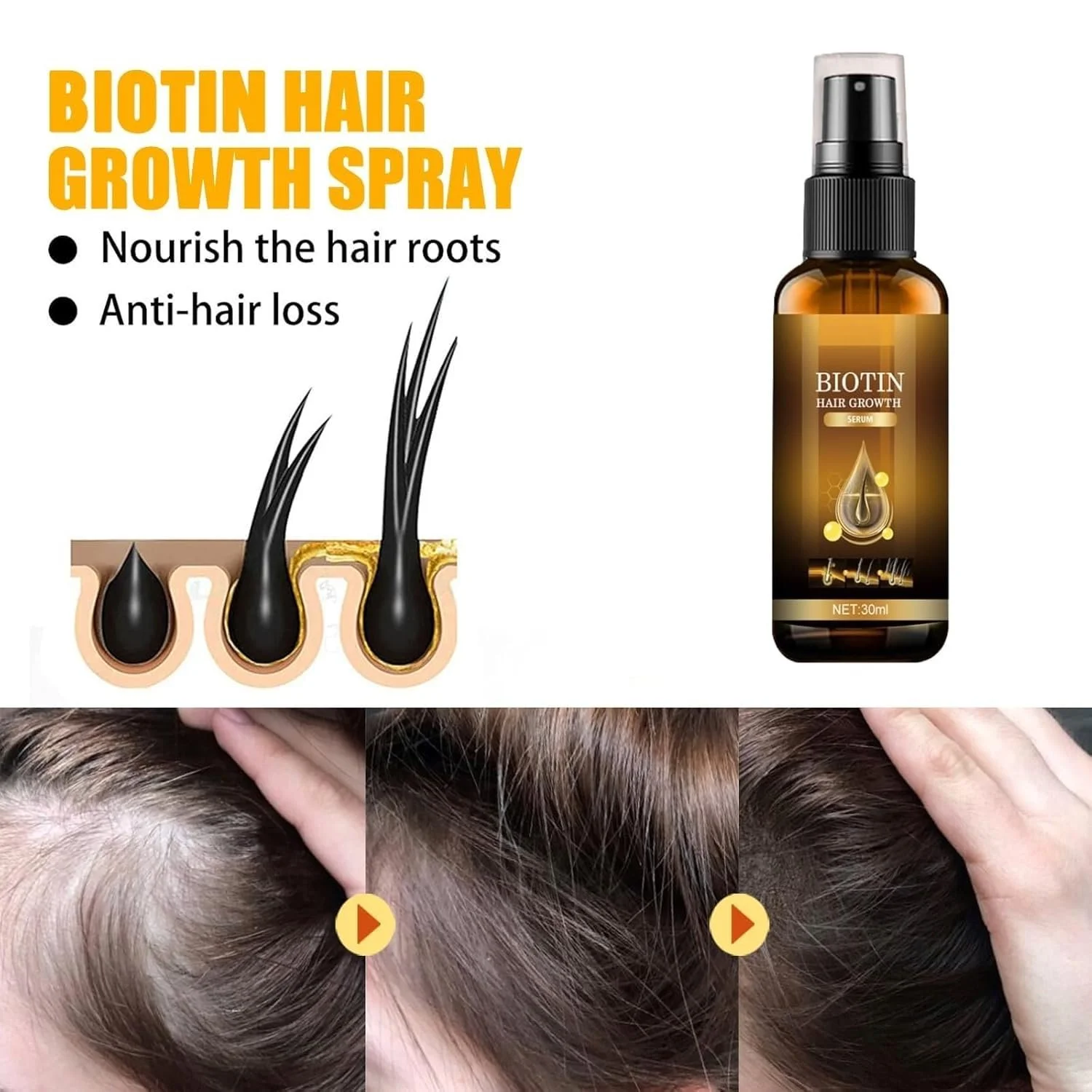 Сироватка для росту волосся Біотин, Спрей для росту волосся Біотин 30 мл, фото №6