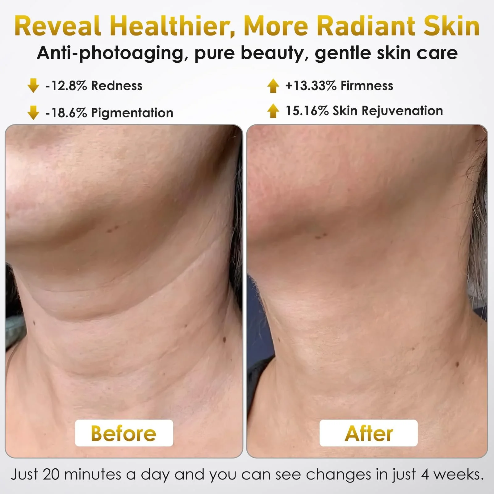 LED Маска для лица Ntyikul 7 цветов света, 5 уровней яркости, красный свет, с пультом дистанционного управления., фото №3