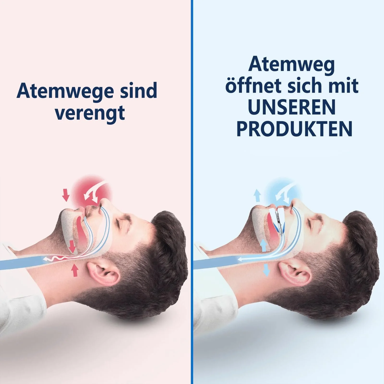 Шина від Хропіння та Протрузії, фото №3