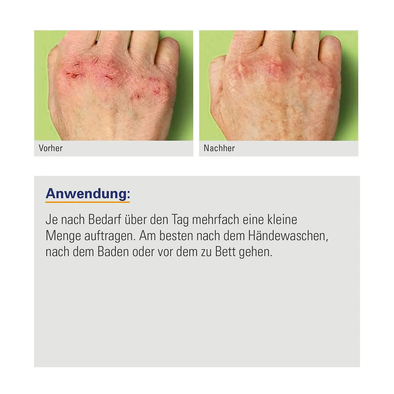 Набор для защиты рук Karl Dahm I Быстро впитывающийся крем для рук + самоклеящийся бинт для пальцев I Уход и защита рук в одном наборе - Артикул 17100, фото №3