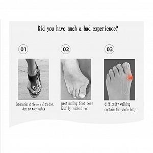 Коректор великого пальця стопи CAZARU, шкарпетка для випрямлення великого пальця стопи, з ремінцем на п'яті synthetic.ua - Фото 1