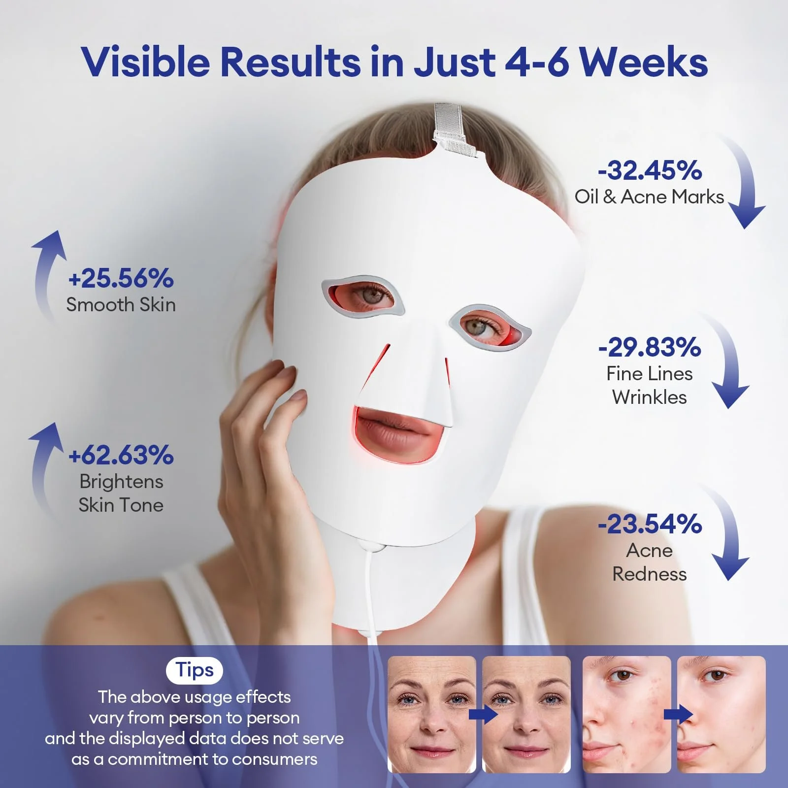 LED Маска для світлової терапії обличчя з дистанційним керуванням для омолодження, підтяжки для всіх типів шкіри, фото №7 LED Маска для світлової терапії обличчя з дистанційним керуванням для омолодження, підтяжки для всіх типів шкіри, фото №7