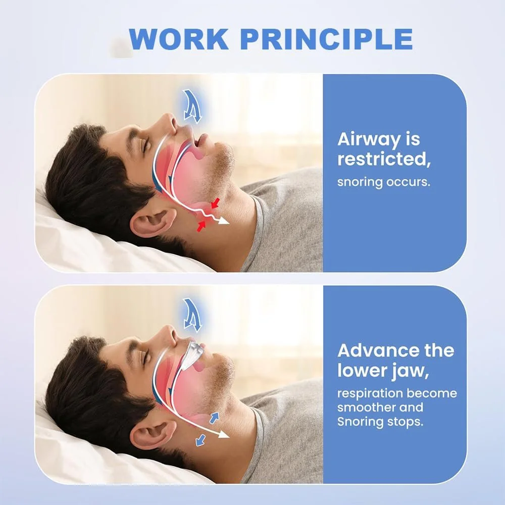 Ротовой фиксатор от храпа Устройство для остановки храпа для тихого сна дыхательные аппараты и носовые полоски для мужчин и женщин, фото №3 Ротовой фиксатор от храпа Устройство для остановки храпа для тихого сна дыхательные аппараты и носовые полоски для мужчин и женщин, фото №3