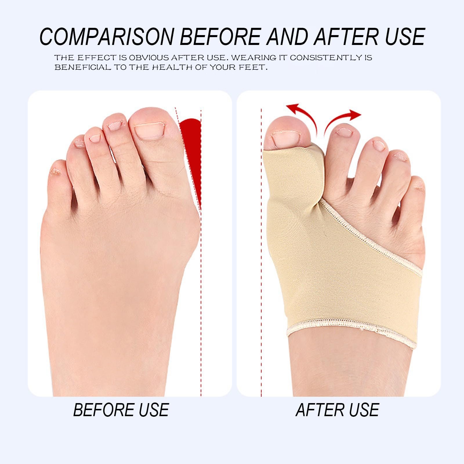 Шкарпетки для корекції вальгусної деформації Epunk Силіконові, тілесного кольору Lycra, фото №4