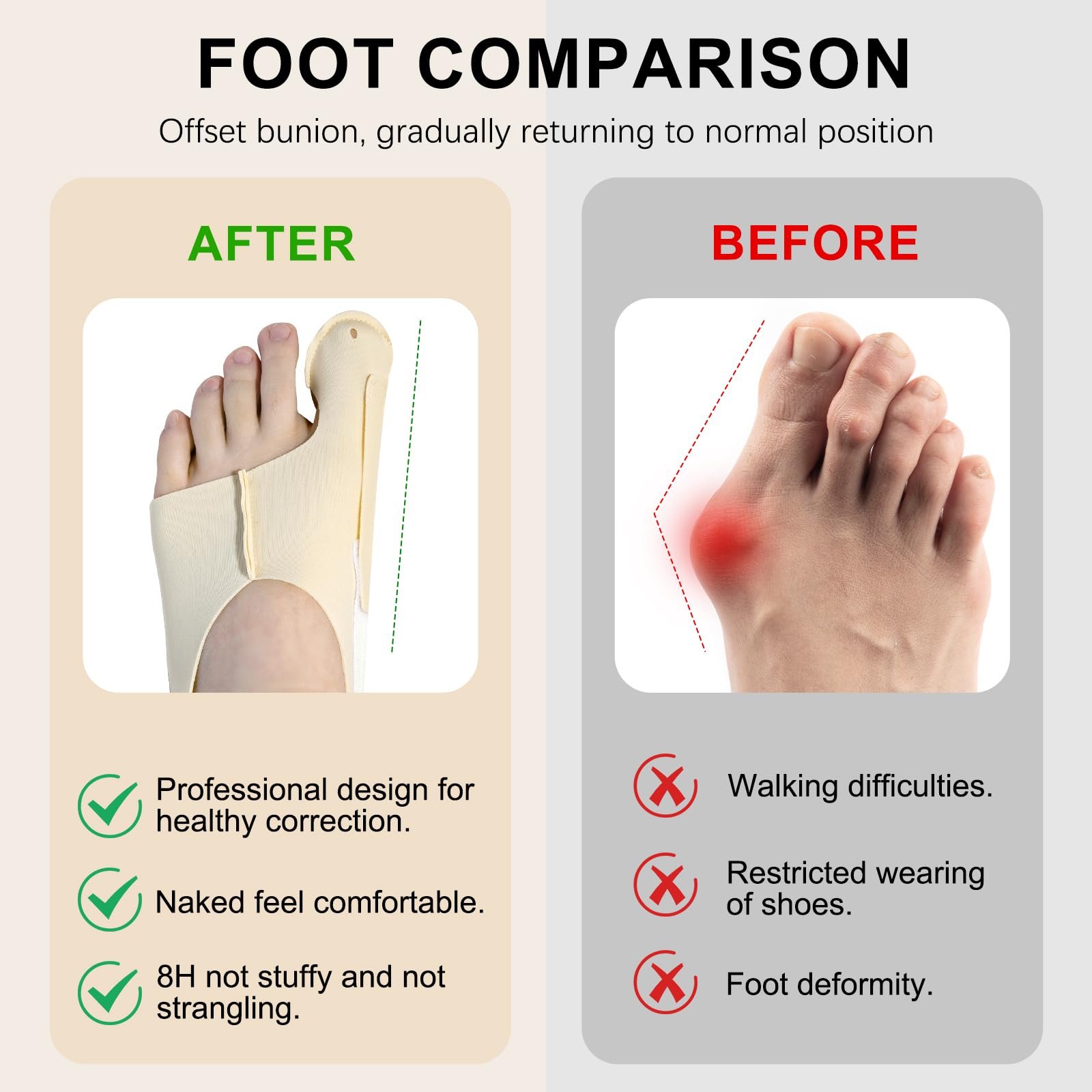 Шина Hallux Valgus 1 пара, фото №5 Шина Hallux Valgus 1 пара, фото №5