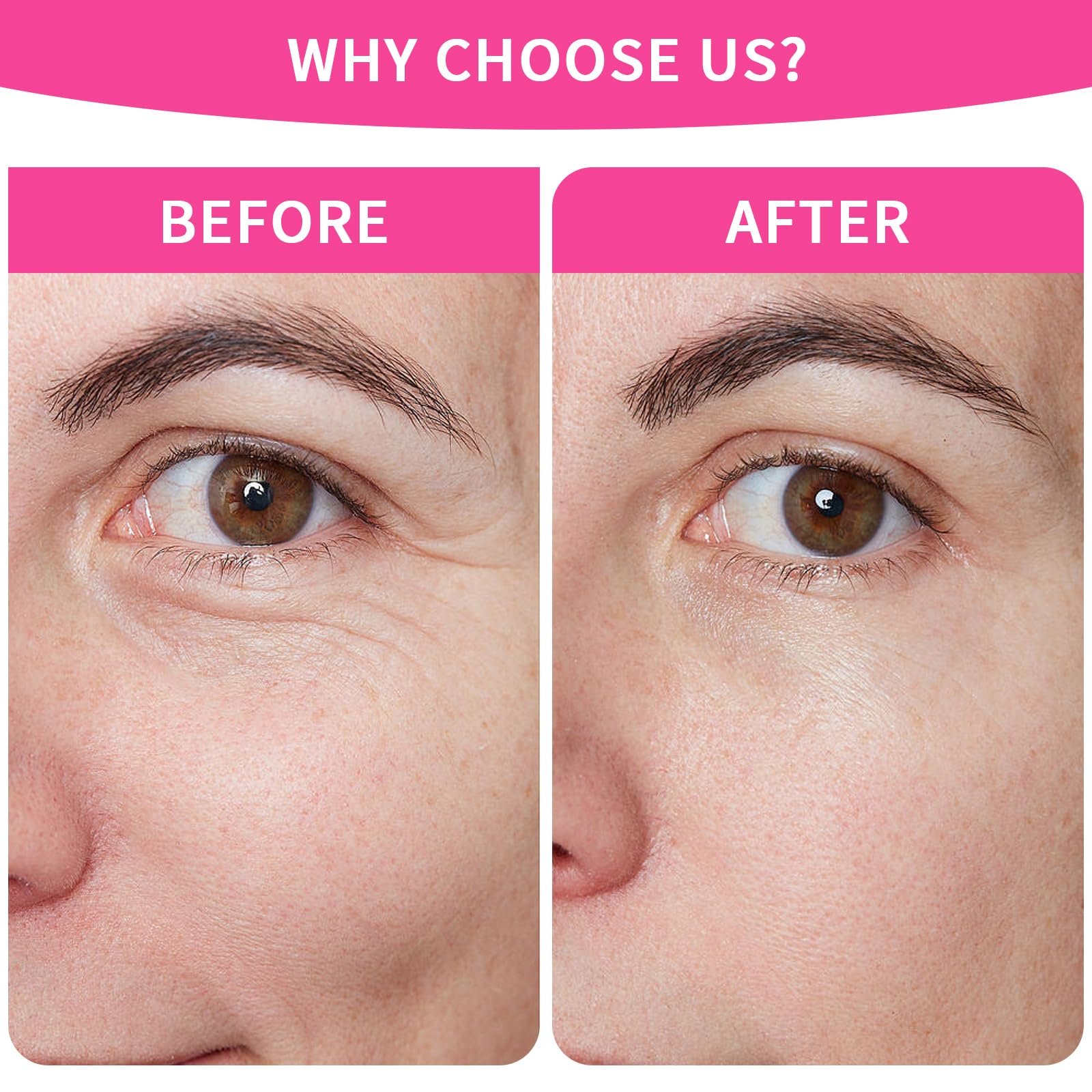 Патчи для лба от морщин, ночные, 3 шт., фото №4 Патчи для лба от морщин, ночные, 3 шт., фото №4