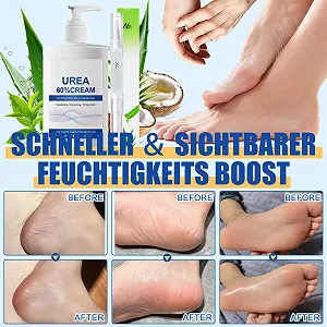 Набор для ухода за ногами: Крем с мочевиной 60% 200 мл и масло для ногтей с алоэ вера synthetic.ua - Фото 1