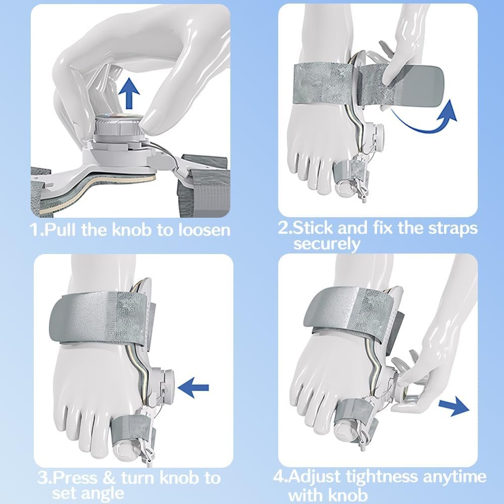 Шина для коррекции Hallux Valgus, регулируемая ортопедическая, фото №6