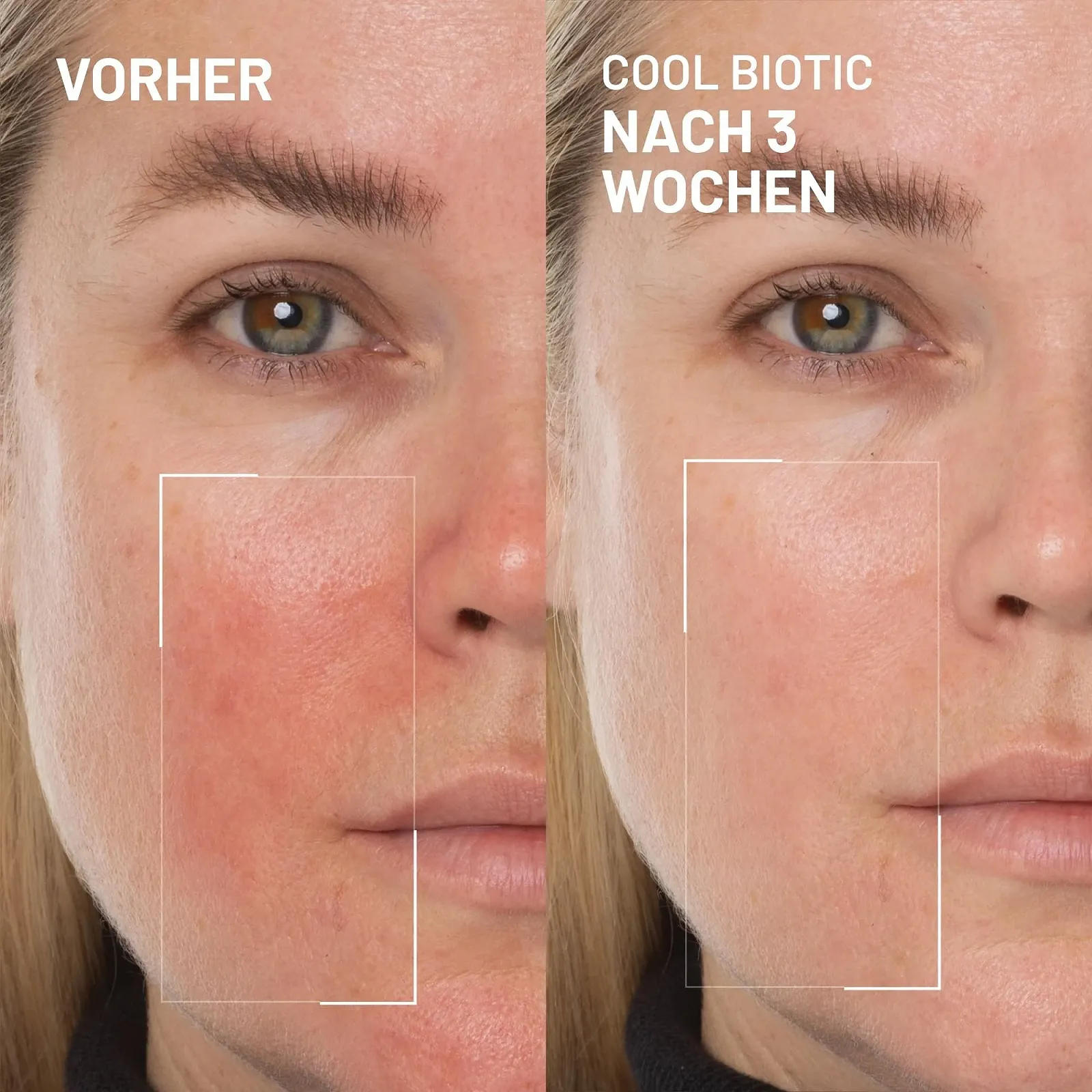 Крем против покраснений Dr. Brandt Cool Biotic Пребиотический Охлаждающий 50 г, фото №2