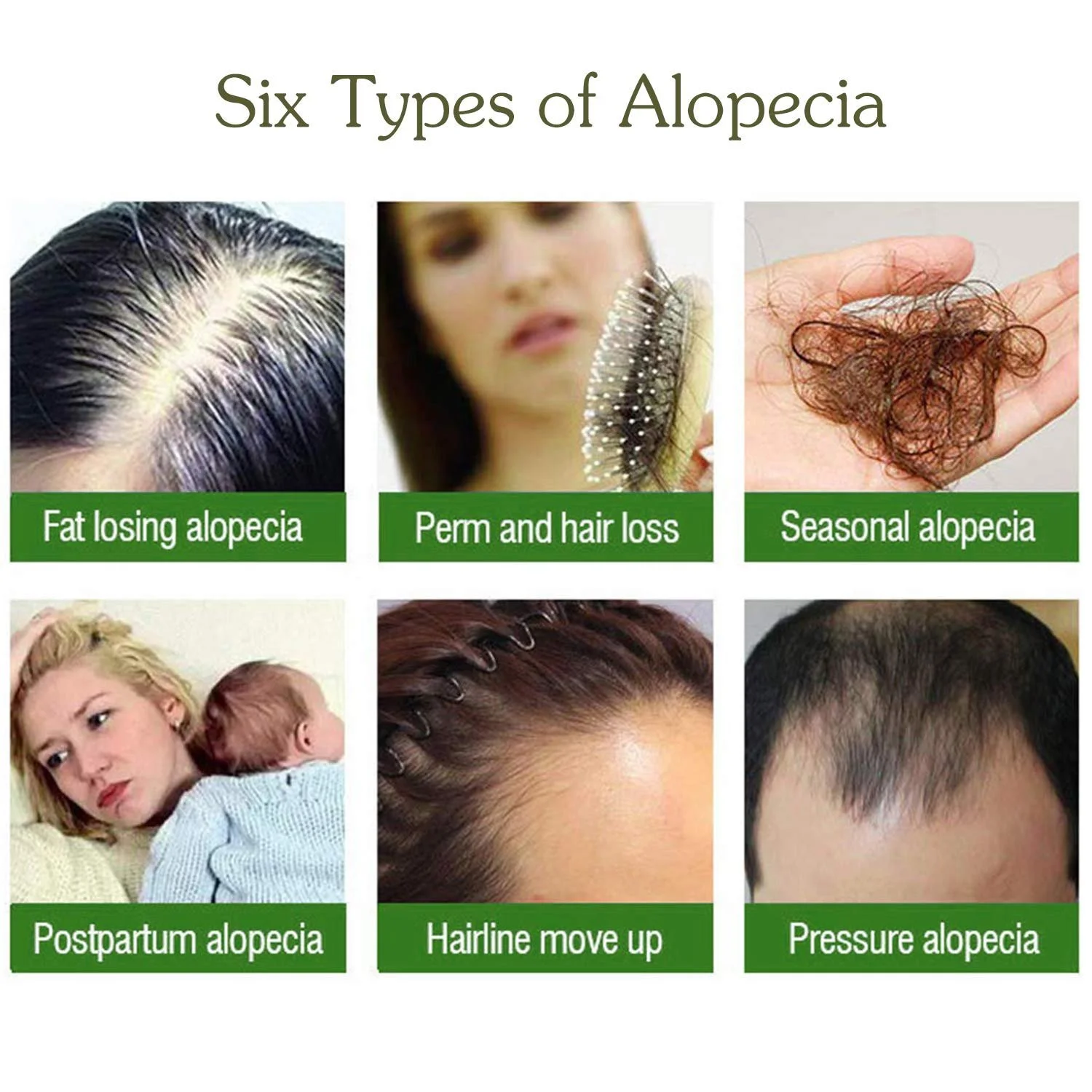 Сироватка для росту волосся Проти випадіння волосся Відновлення волосяних фолікулів 30 мл, фото №3