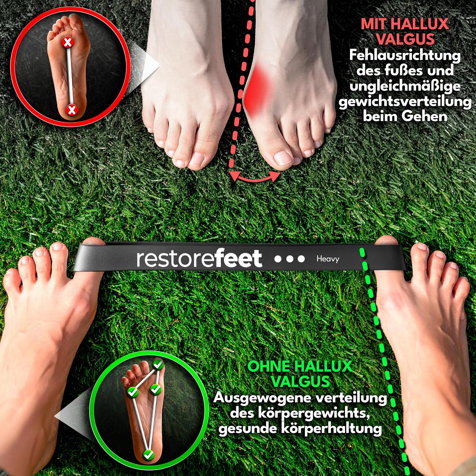 Пов'язка для корекції Hallux Valgus 3 еластичні стрічки опору (28 см) для вирівнювання великого пальця ноги Ортопедична, фото №2 Пов'язка для корекції Hallux Valgus 3 еластичні стрічки опору (28 см) для вирівнювання великого пальця ноги Ортопедична, фото №2