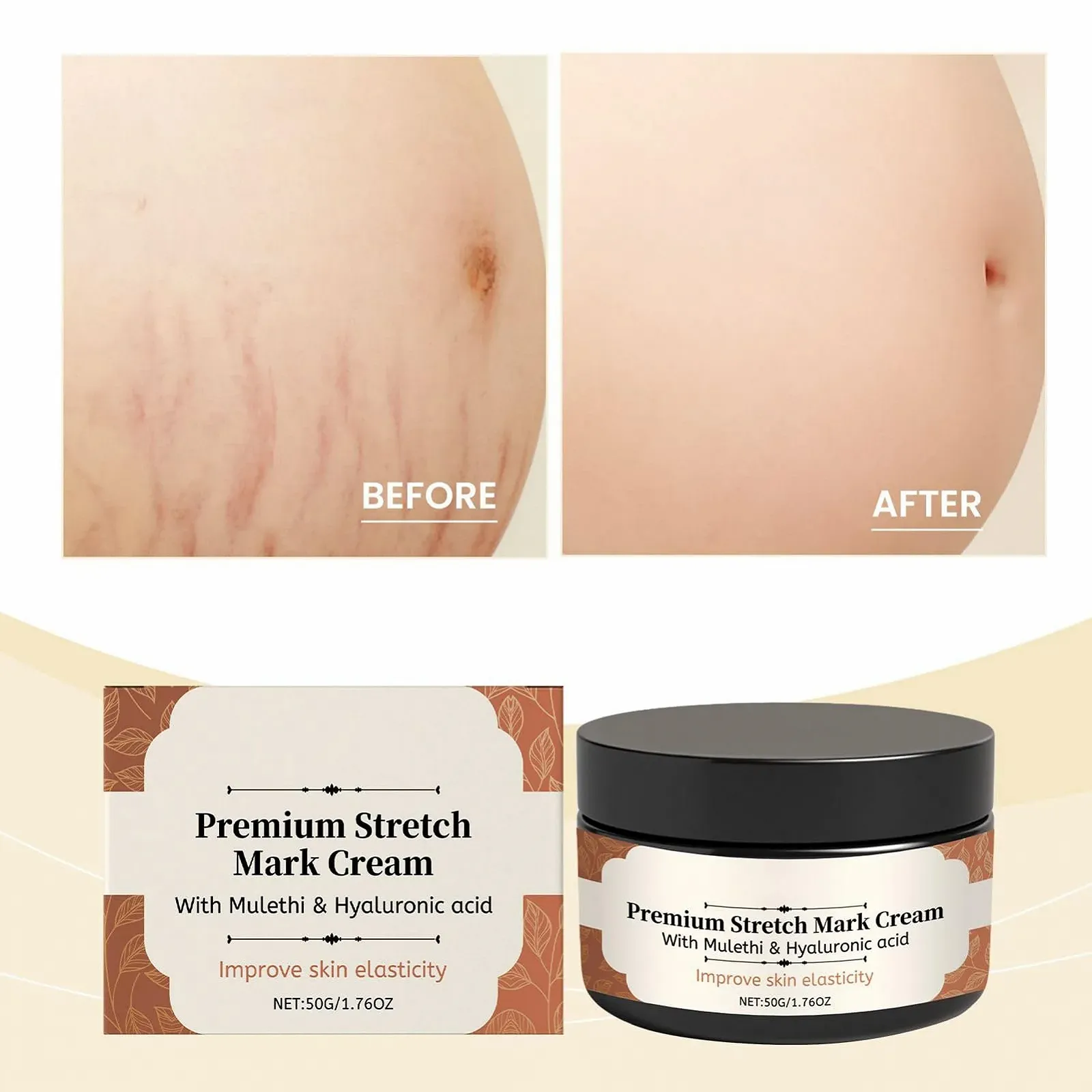 Крем от растяжек для беременных 50 г Крем для живота Обезжиривающий лосьон для беременных Предотвращает растяжки и улучшает эластичность, фото №3