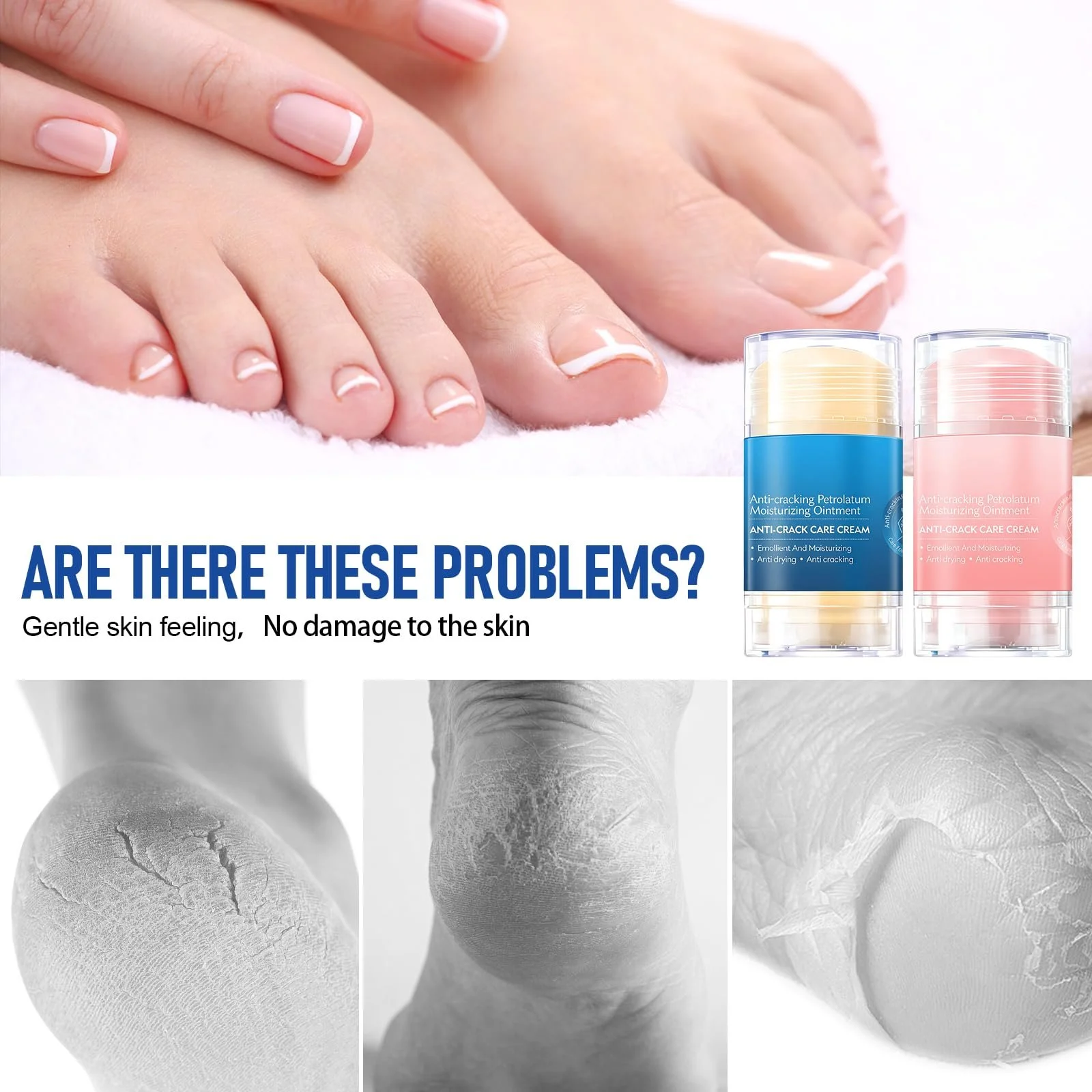 Крем-стик для ног Foot Cream для сухой кожи и трещин интенсивный против мозолей быстро впитывающийся, фото №3