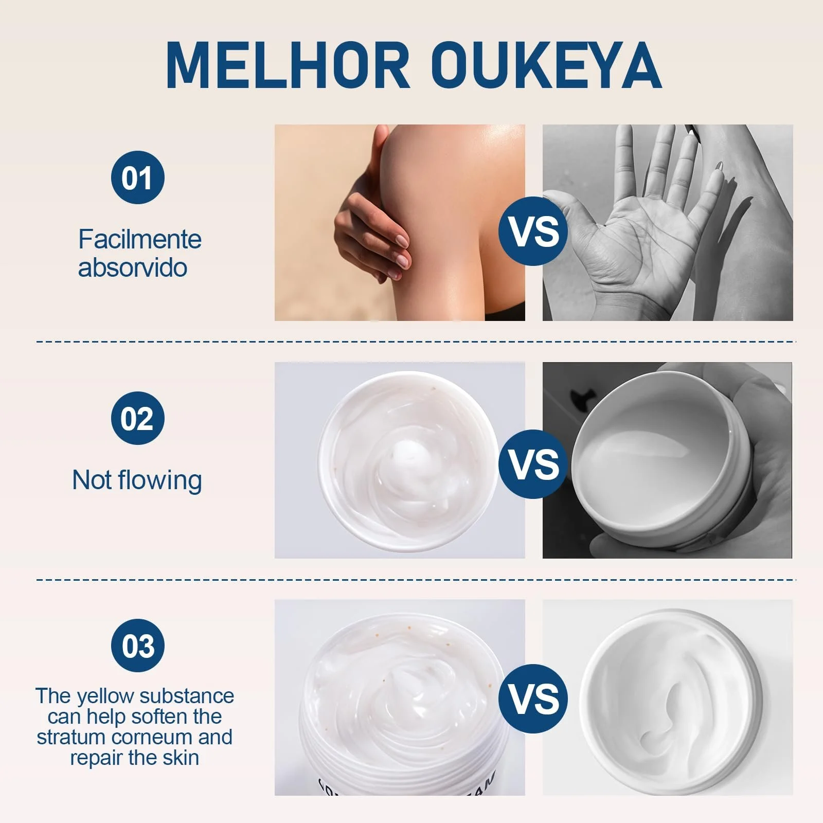 Крем для ног Urea Cream 40% интенсивный увлажняющий с гиалуроновой кислотой 150 г, фото №4