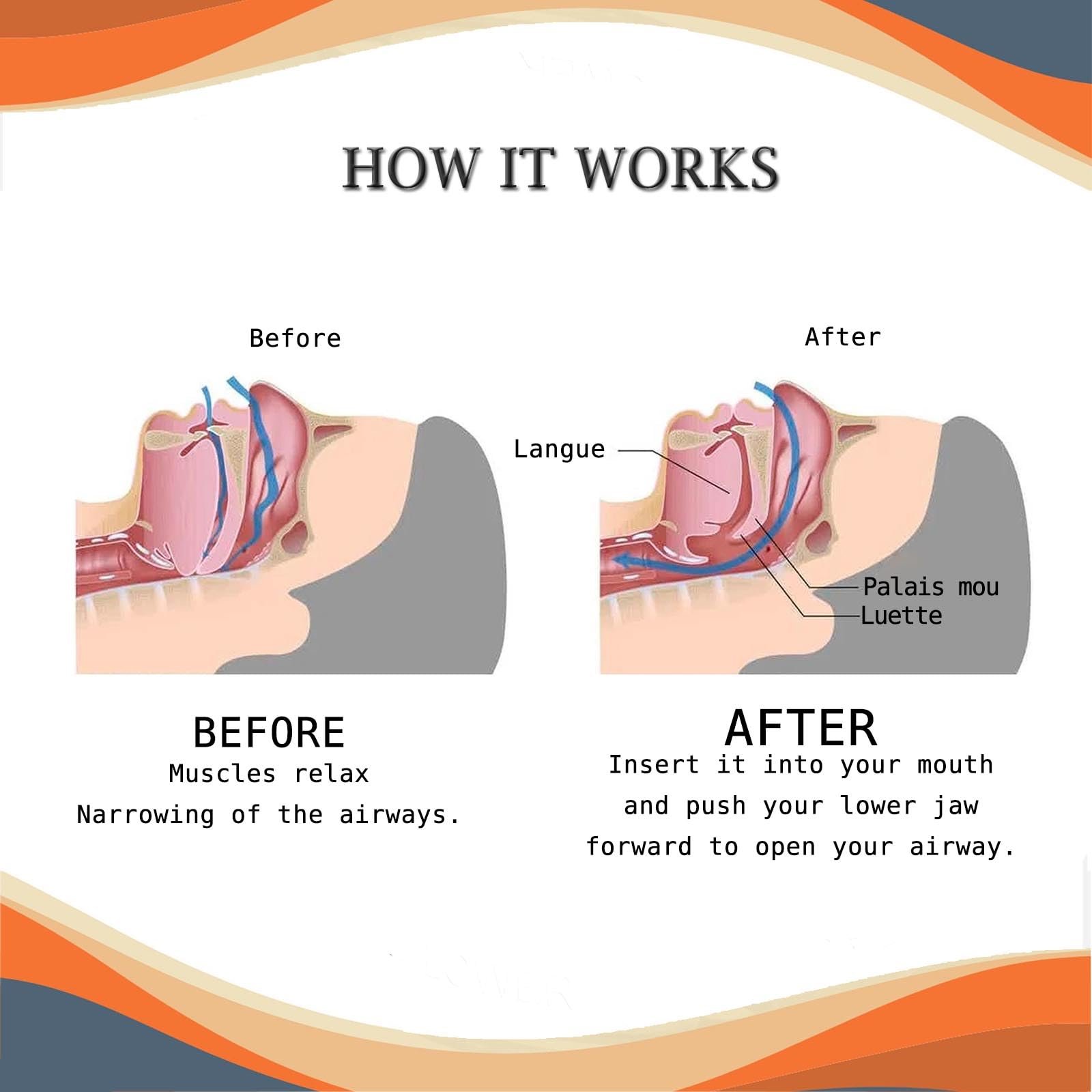 Пристрій від хропіння Регульований пристрій, фото №7