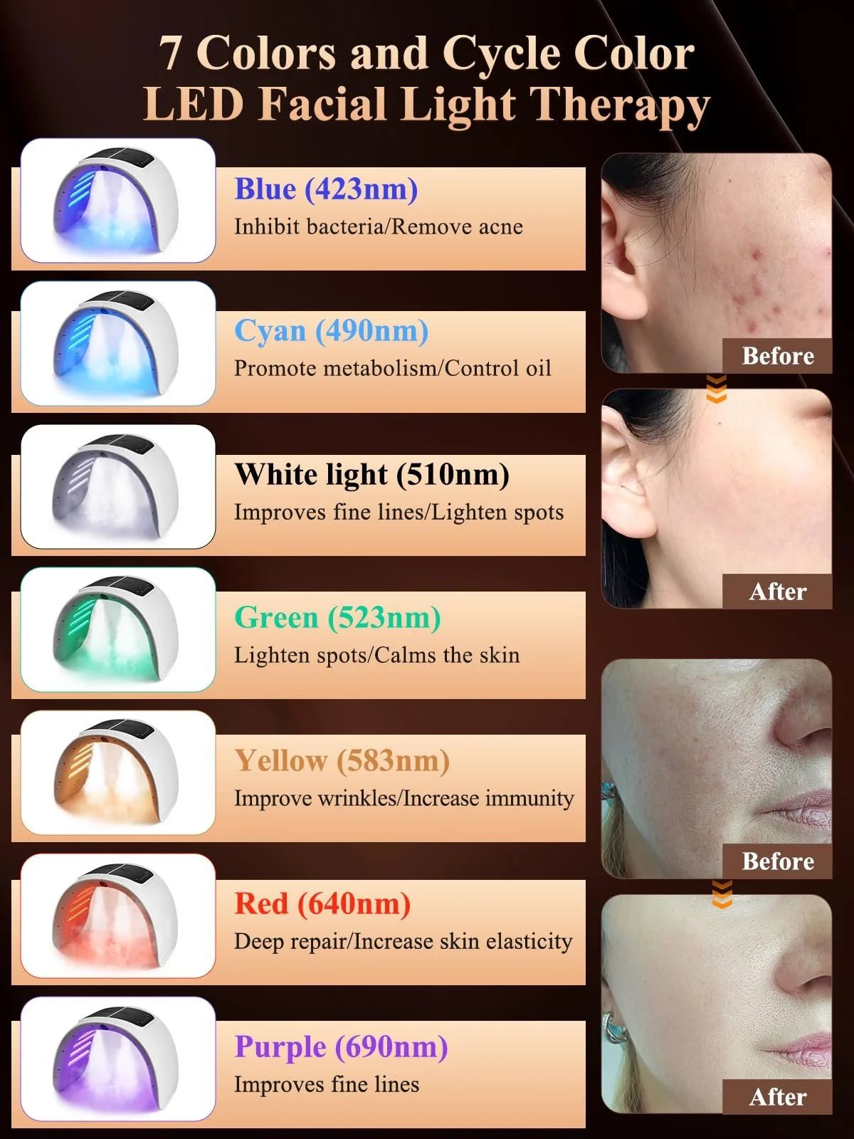 LED Маска для світлової терапії обличчя CENBEII, фото №2 LED Маска для світлової терапії обличчя CENBEII, фото №2