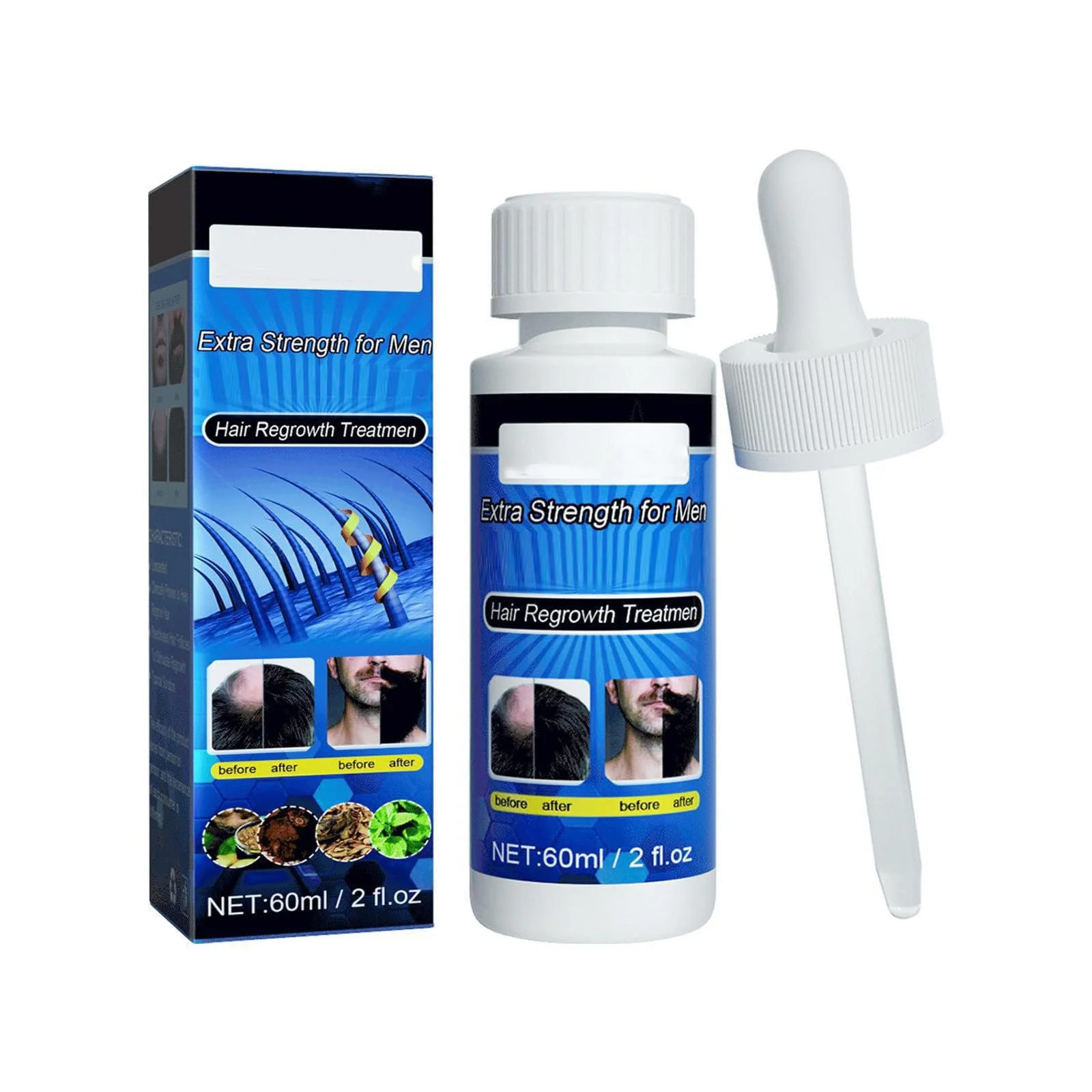 Сироватка для росту волосся Biotin Und Rizinus Haarwachstum Haarwachstum Lösung Anti Haarausfall для чоловіків та жінок, фото №1 Сироватка для росту волосся Biotin Und Rizinus Haarwachstum Haarwachstum Lösung Anti Haarausfall для чоловіків та жінок, фото №1