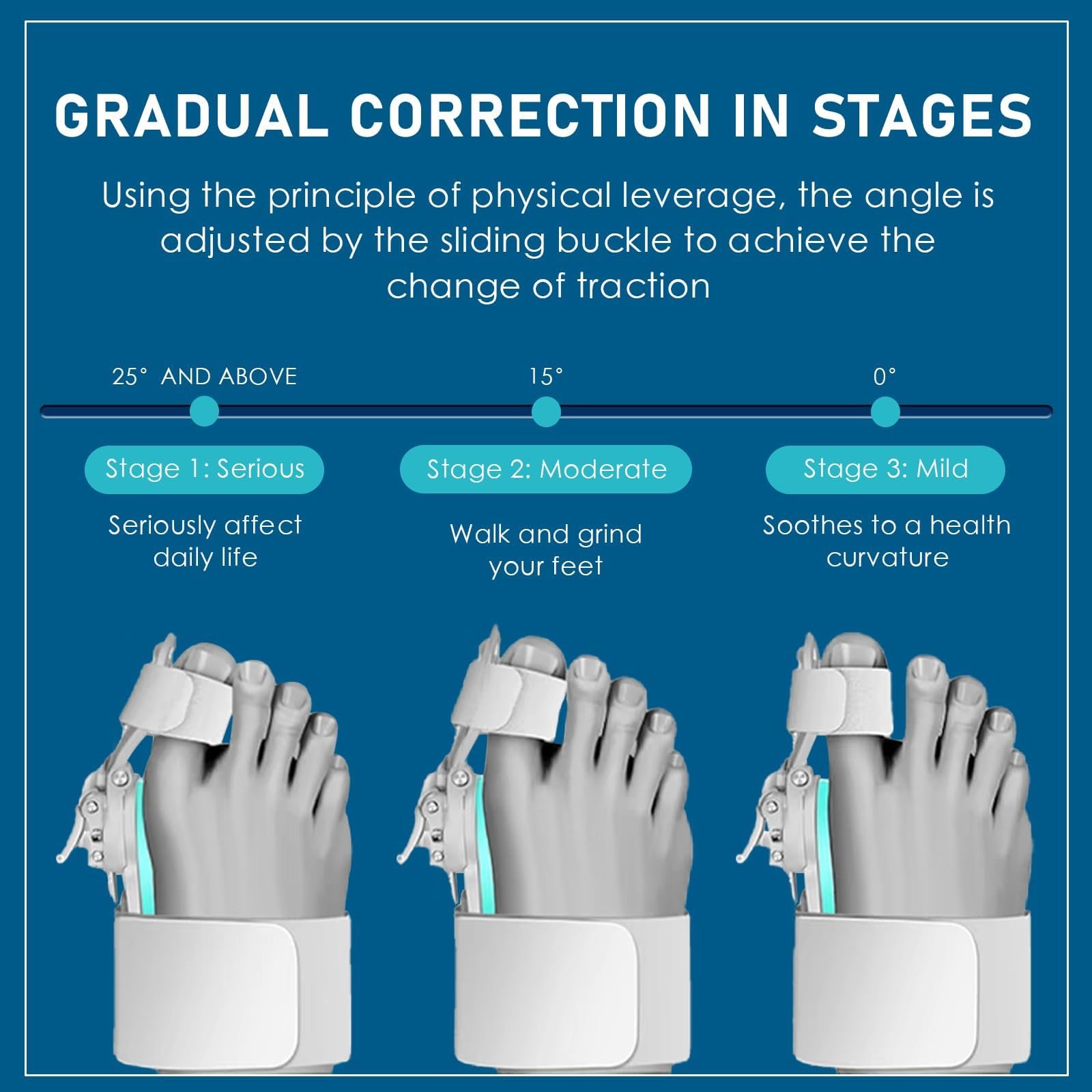 Корректор Hallux Valgus Фиксирующая пластина, Регулируемая шина Hallux Valgus, Эластичный корректор вальгусной деформации, Ортопедический корректор вальгусной деформации для мужчин и женщин, фото №3