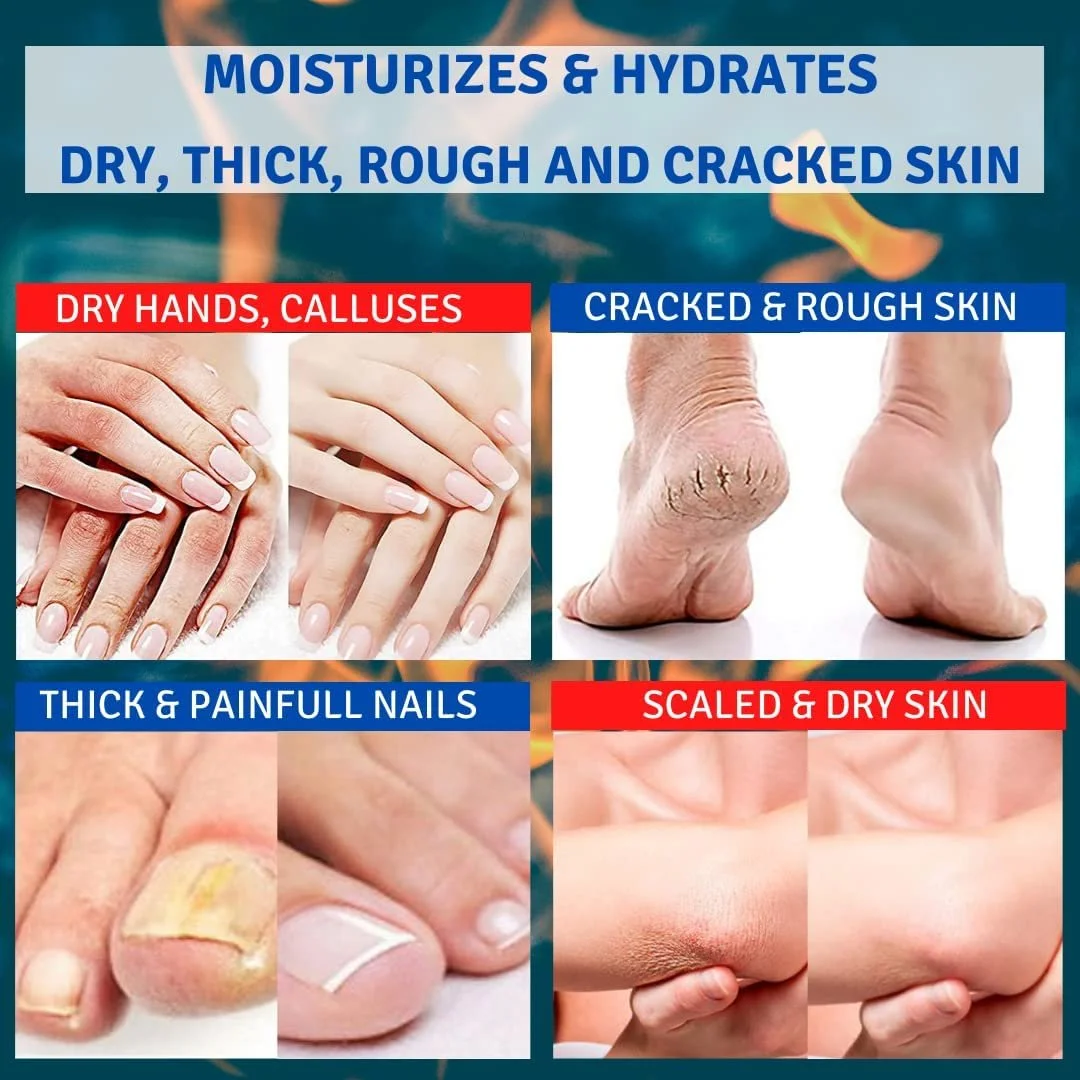 Крем для ног с мочевиной 30% для экстремально сухой и огрубевшей кожи интенсивный увлажняющий 50 мл, фото №2