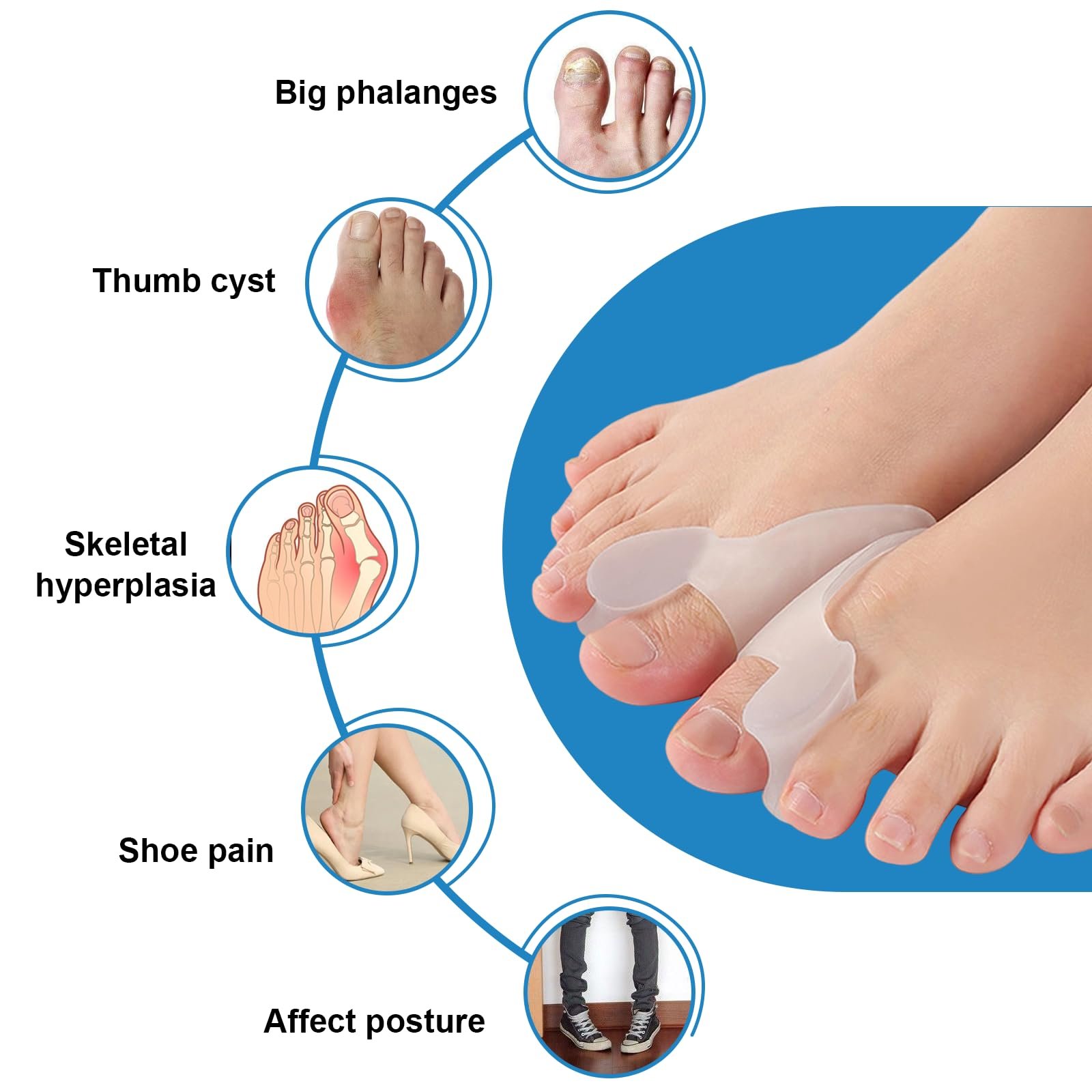 Роздільник для пальців ніг Ecarteur 6 шт., Коректор вальгусної деформації великого пальця стопи, фото №5