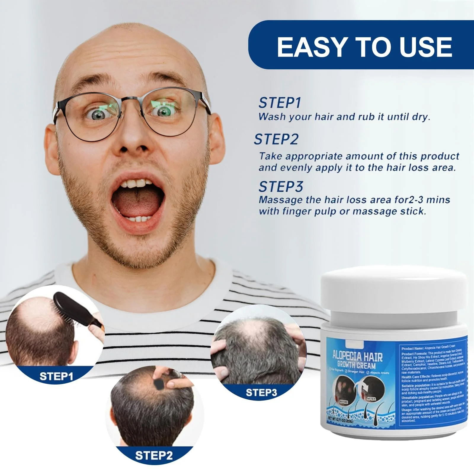 Крем для росту волосся, крем проти випадіння волосся, 20 г, фото №6 Крем для росту волосся, крем проти випадіння волосся, 20 г, фото №6