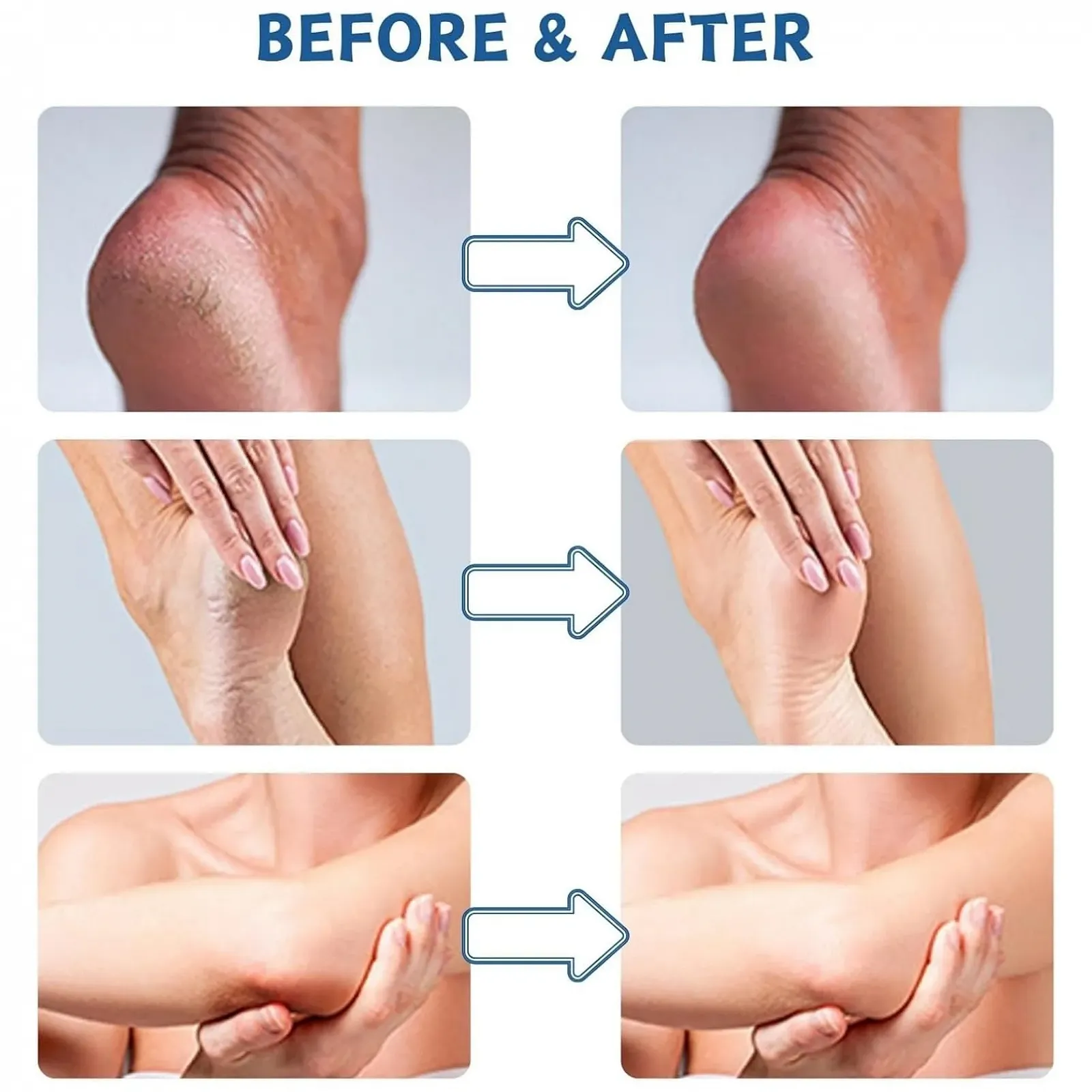 Крем для ног Urea 42% для сухой кожи и потрескавшихся пяток 2 шт., фото №5