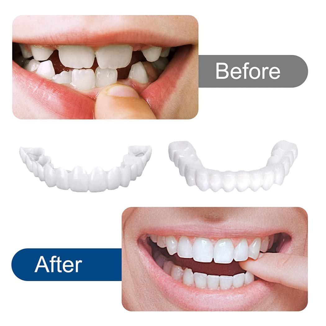 Тимчасові вініри для зубів Instant Perfect Smile Comfort Fit верхні та нижні з контейнером, фото №4