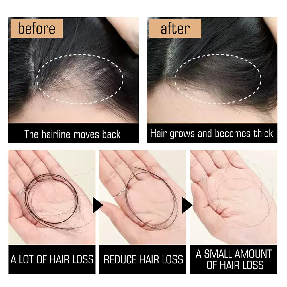 Твердий шампунь Ginger Hair Regrowth проти випадіння волосся, фото №5