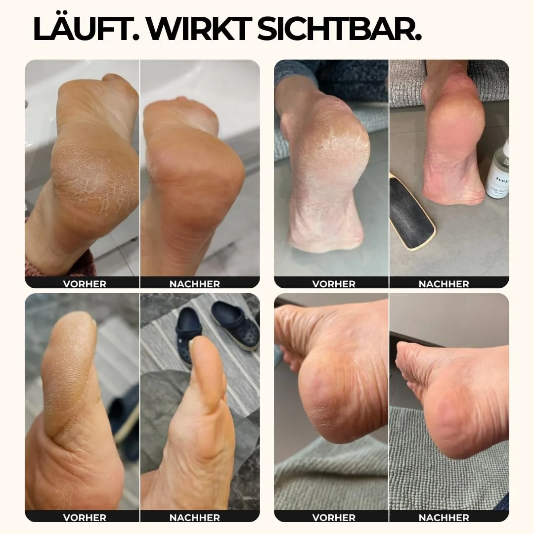 Крем для ног tvey" с сечовиной 10%, маслом ши и авокадо против мозолей 75 мл веганский, фото №6