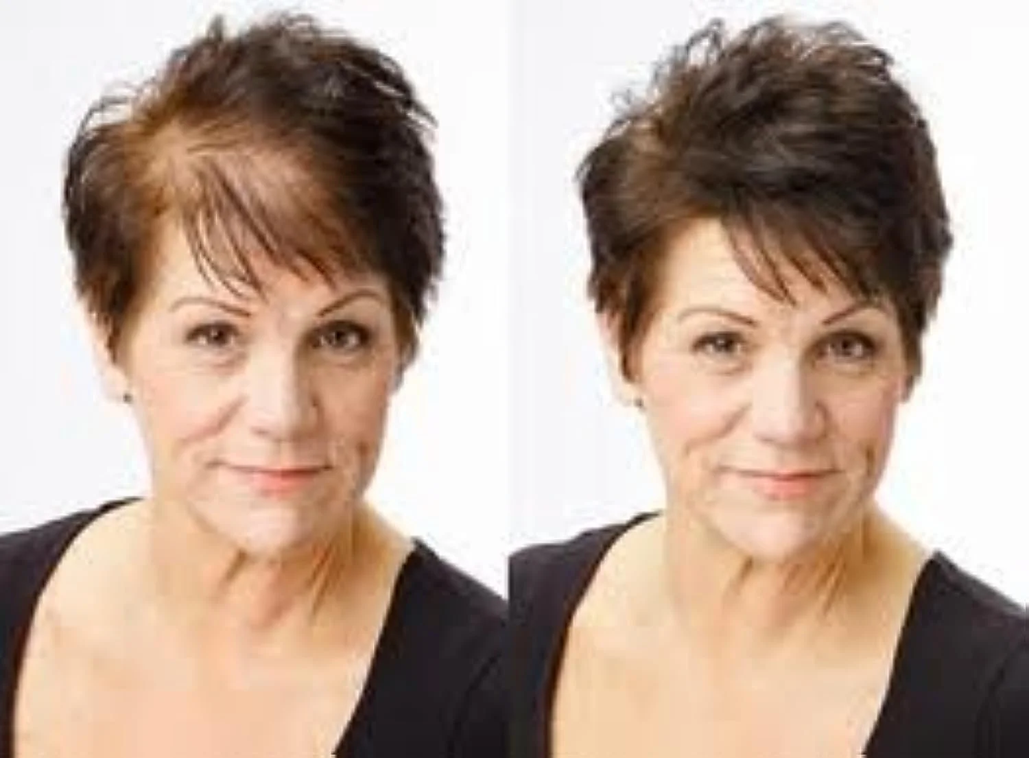 Волокна для волосся Beaver KERATIN для маскування залисин 28г Темно-коричневий, фото №4 Волокна для волосся Beaver KERATIN для маскування залисин 28г Темно-коричневий, фото №4