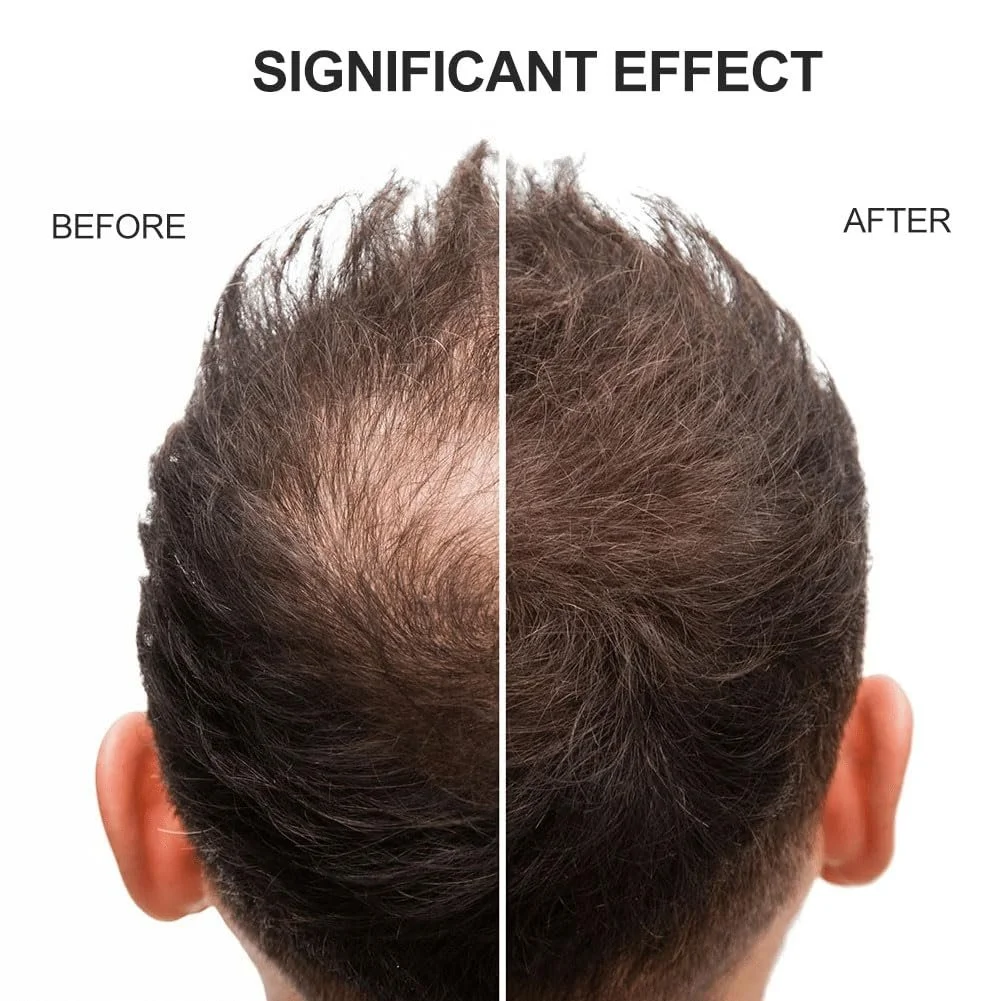 Волокна для волос Dark Brown, фото №6