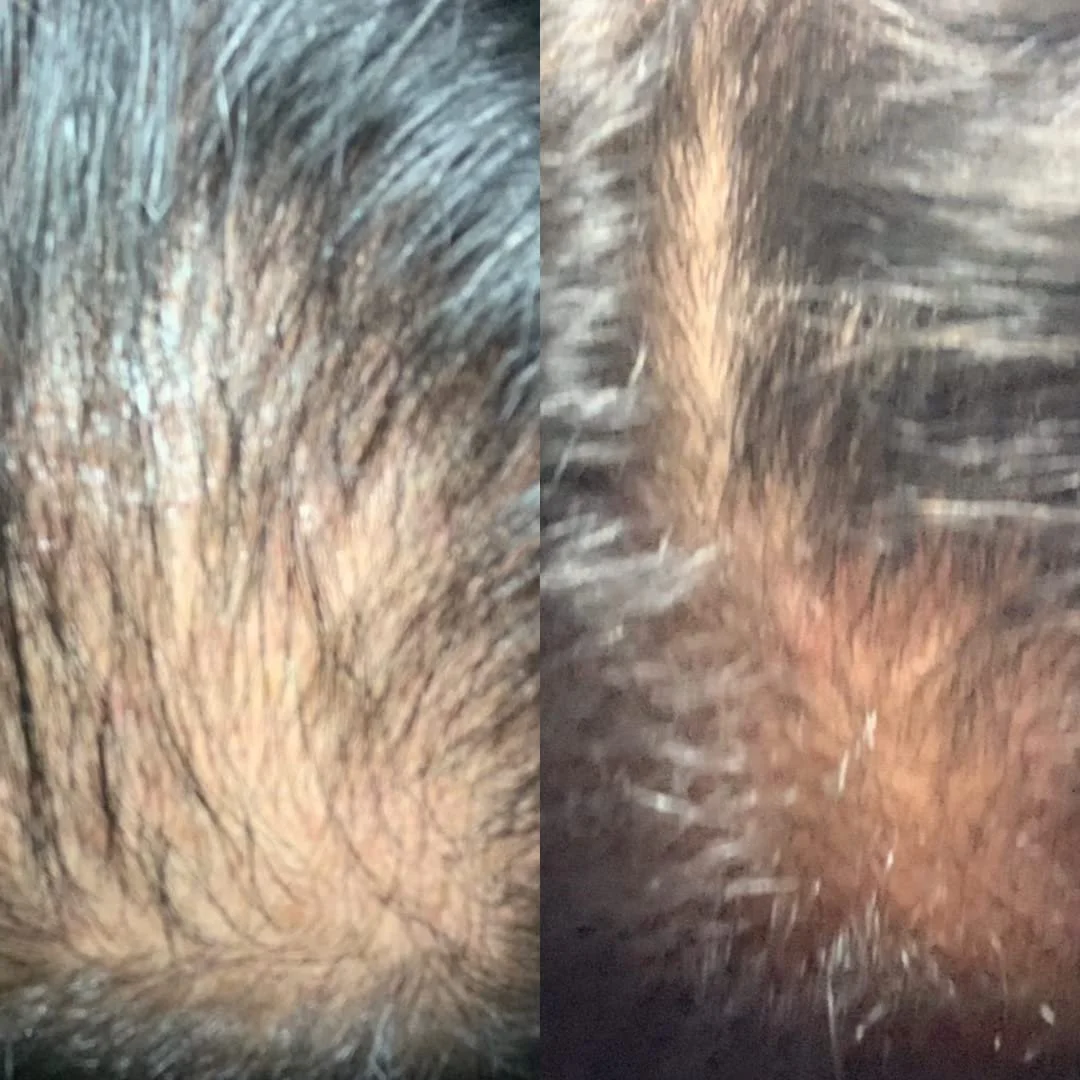 Лосьйон проти випадіння волосся Tricostrong Stanartis 100 мл, фото №9