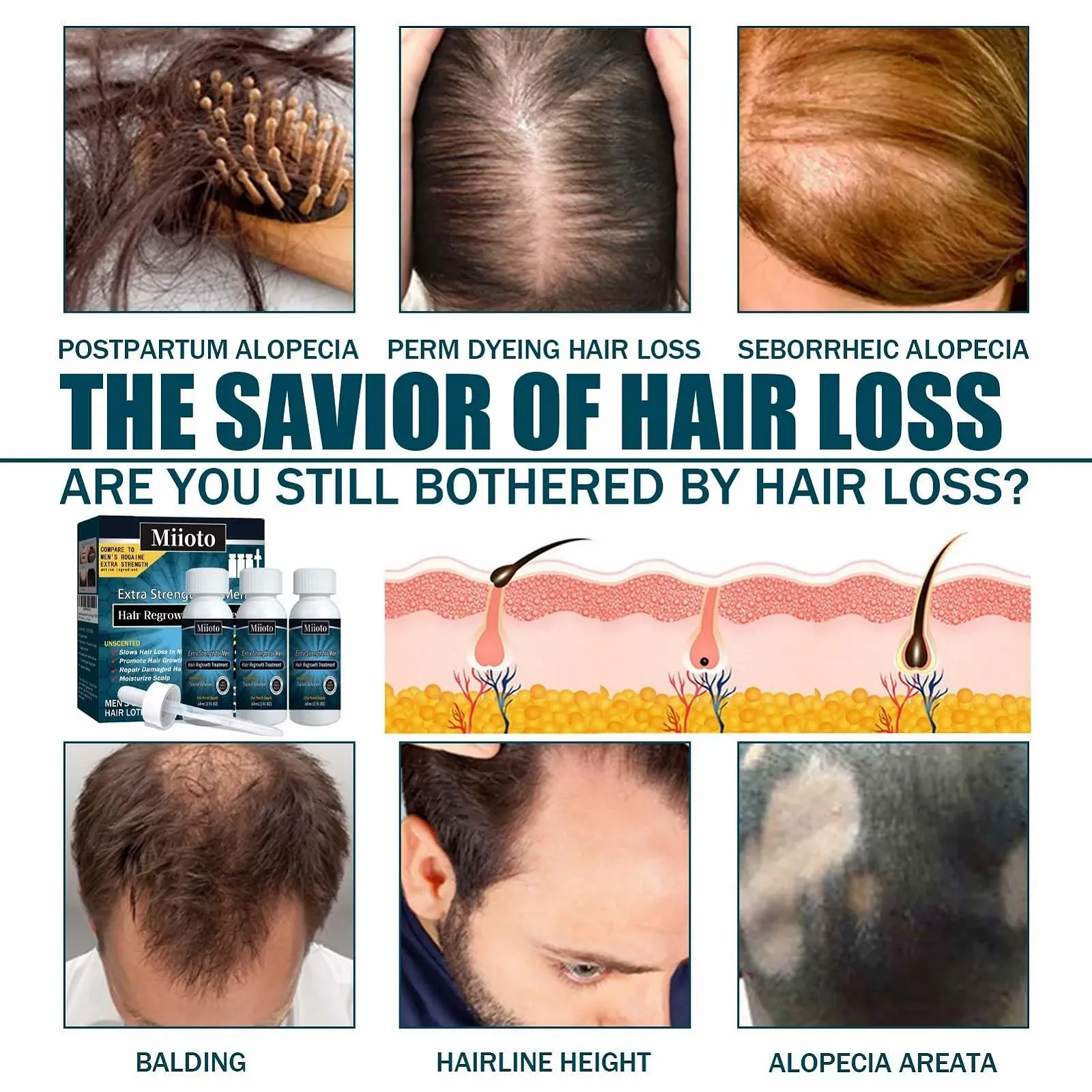 Сыворотка Miioto для роста волос, 180 мл, фото №2