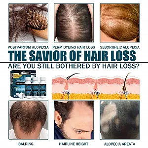 Сыворотка Miioto для роста волос, 180 мл synthetic.ua - Фото 1