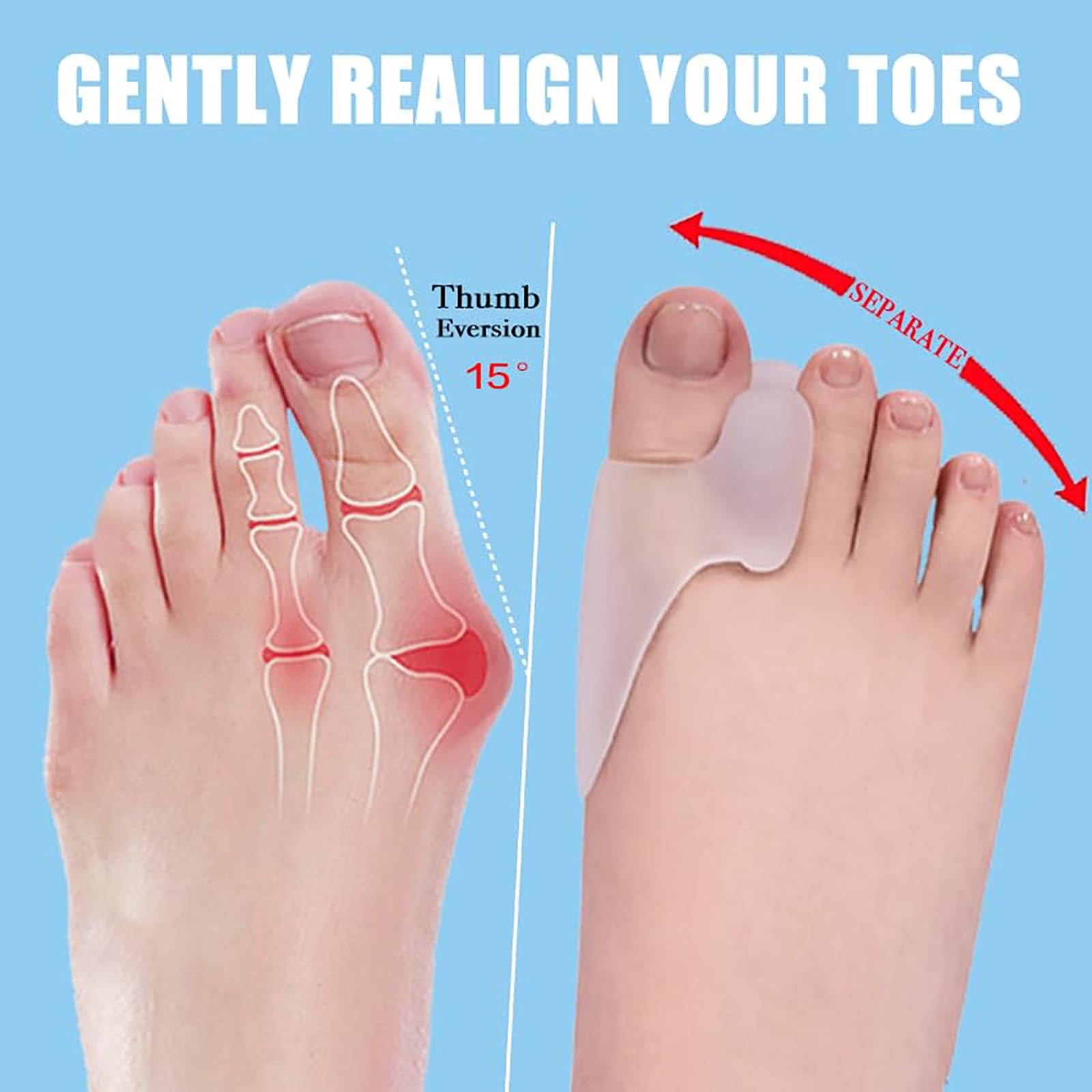 Разделители для пальцев ног для коррекции Hallux Valgus 10 шт., фото №3