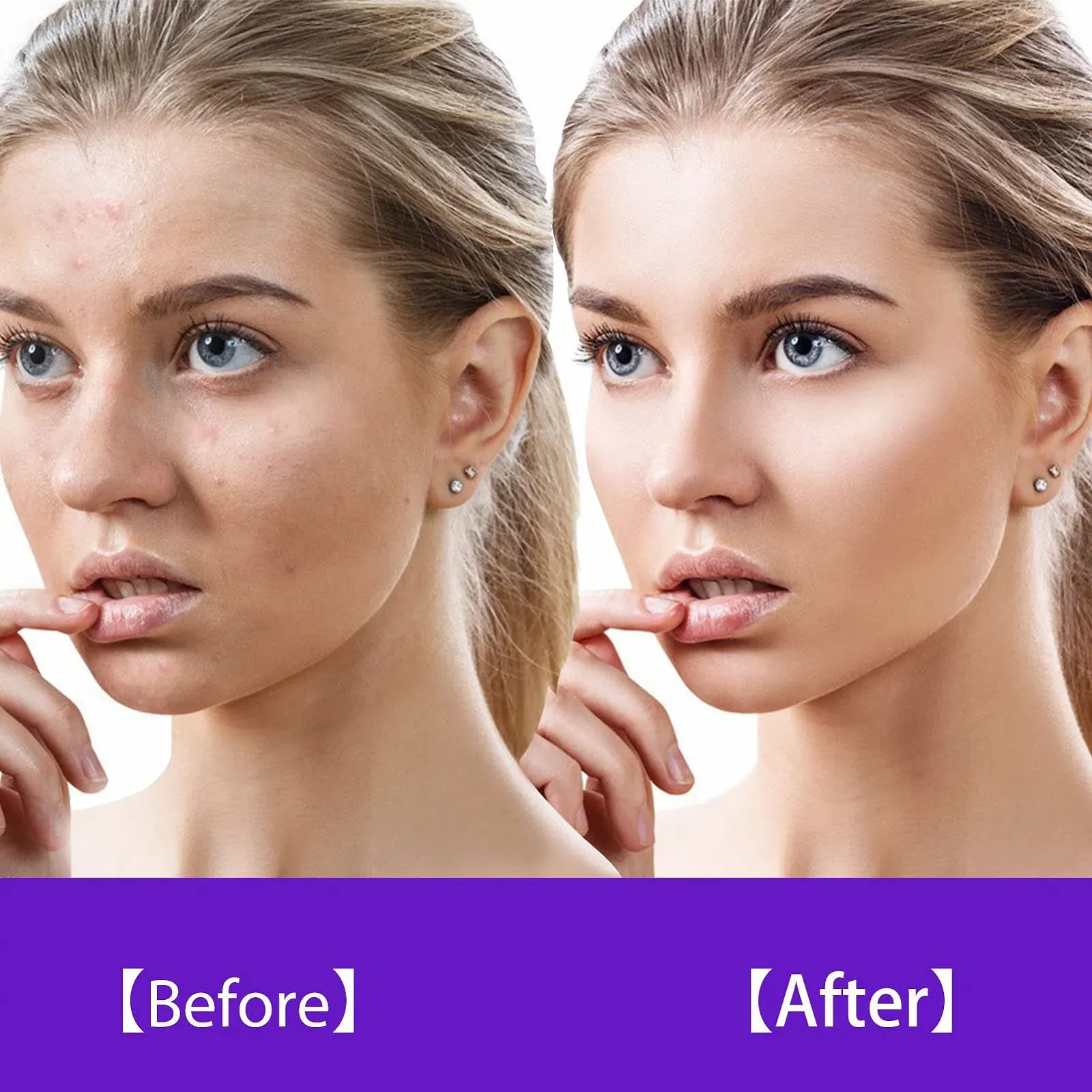 Портативний апарат дарсонваль KingSaid для обличчя та волосся з 4 електродами, фото №5