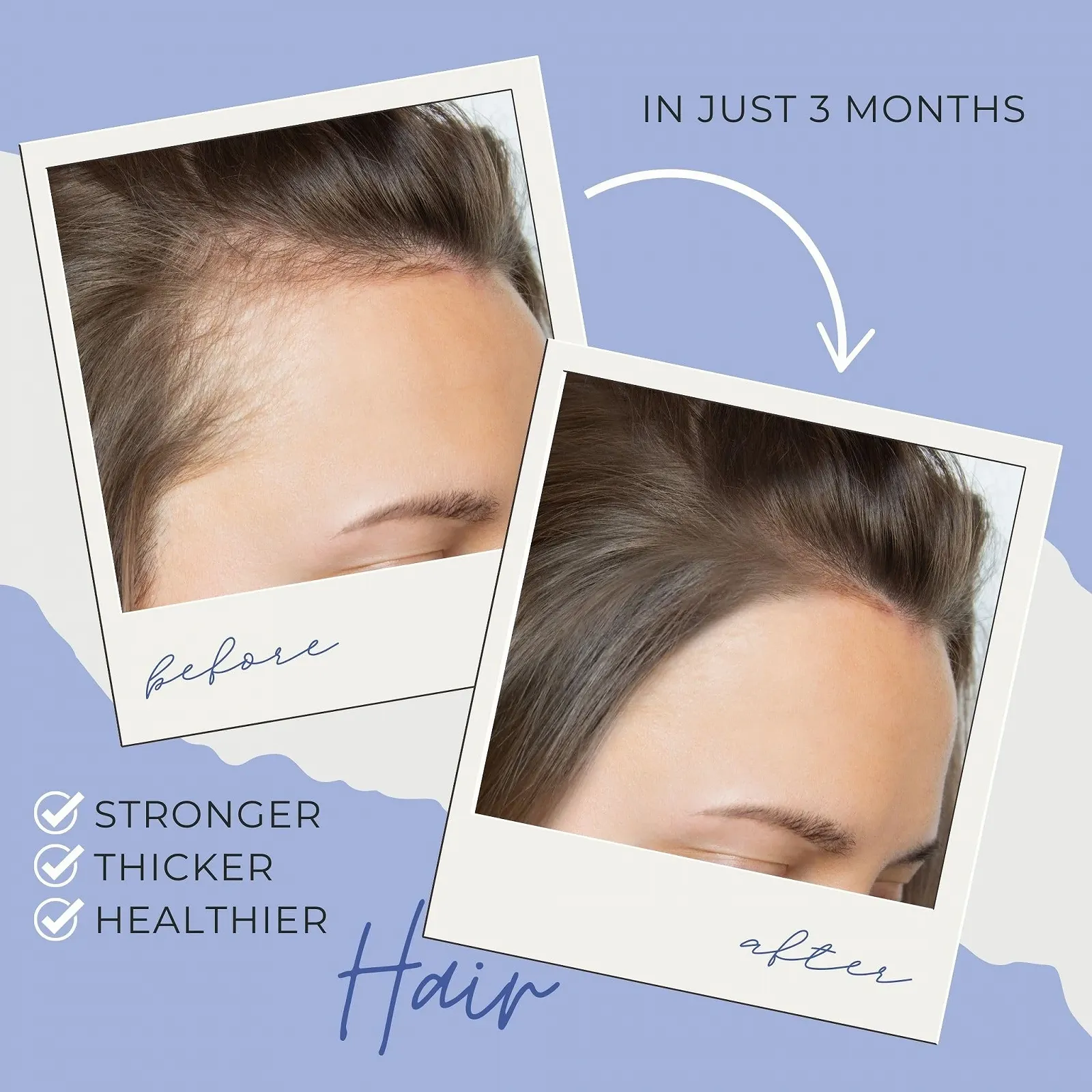 Спрей для росту волосся Medulla Clinic з олією Батани, розмарином, біотином і кофеїном, фото №6 Спрей для росту волосся Medulla Clinic з олією Батани, розмарином, біотином і кофеїном, фото №6